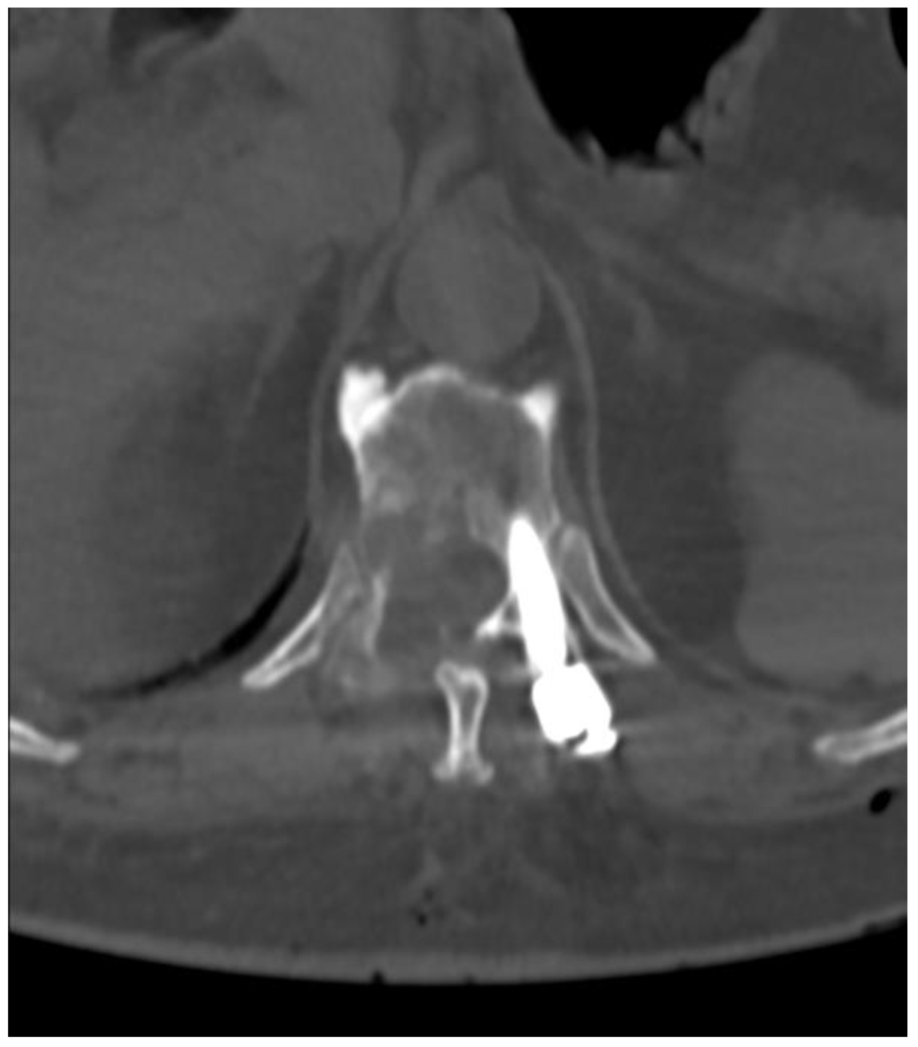 Medicina 59 00993 g008 Medicina 59 00993 g008
