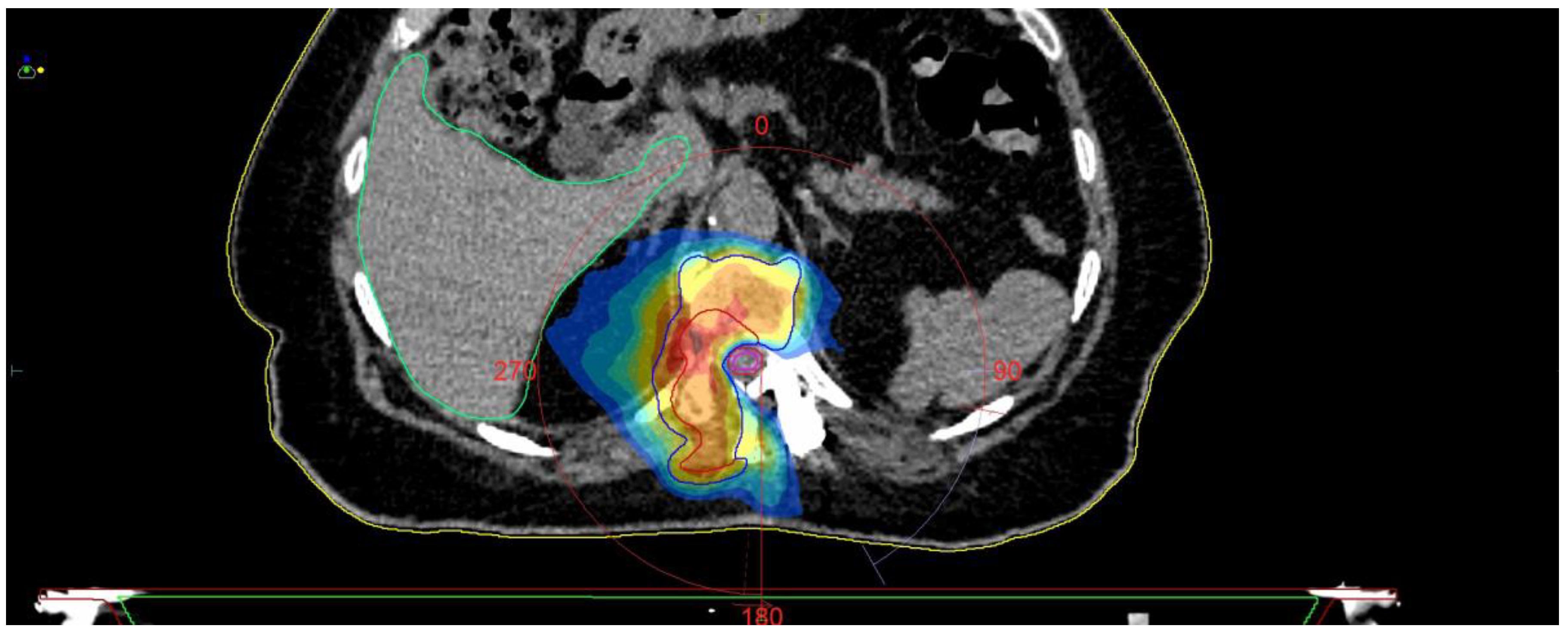 Medicina 59 00993 g010 Medicina 59 00993 g010