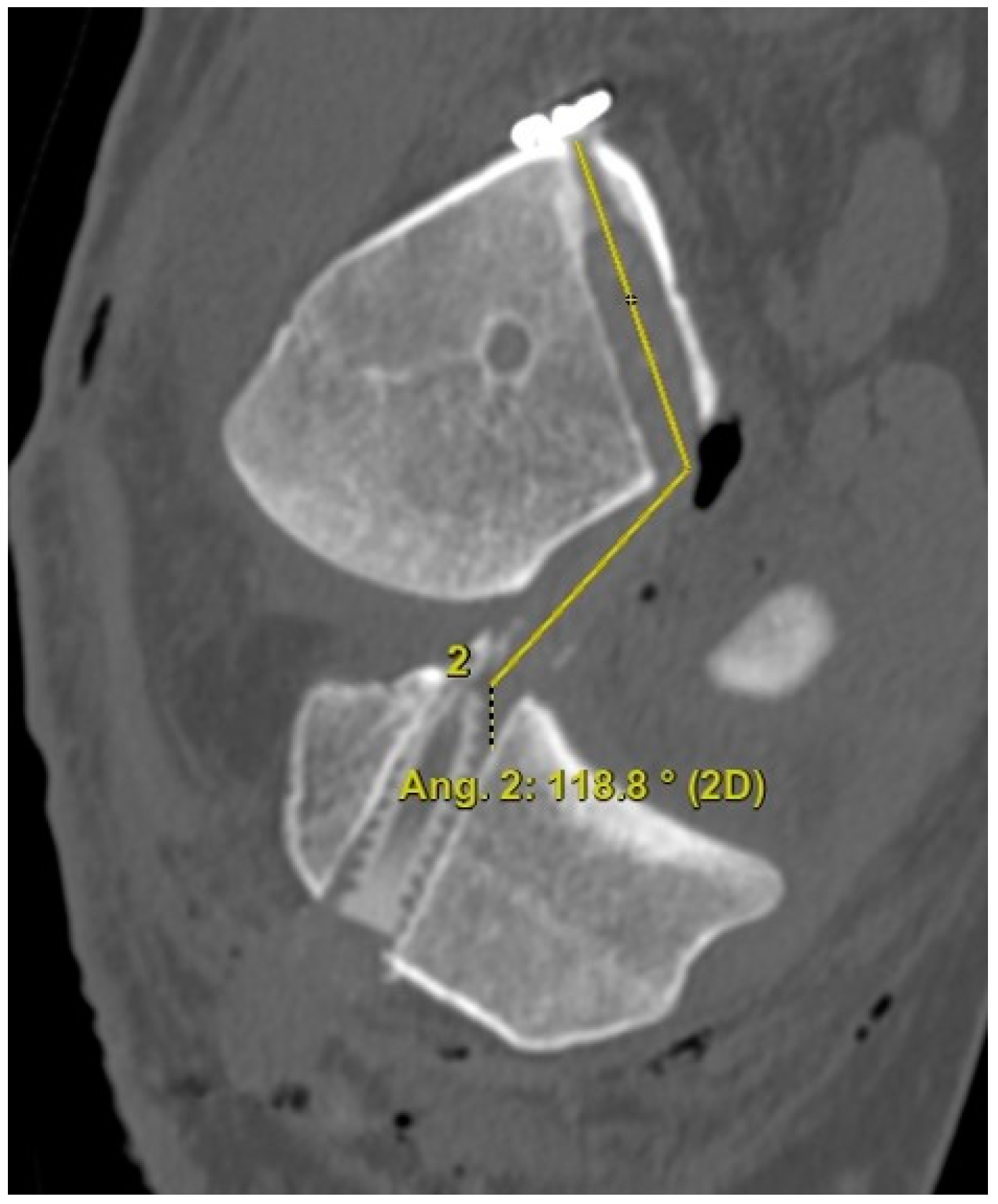 Medicina 59 01031 g003 Medicina 59 01031 g003