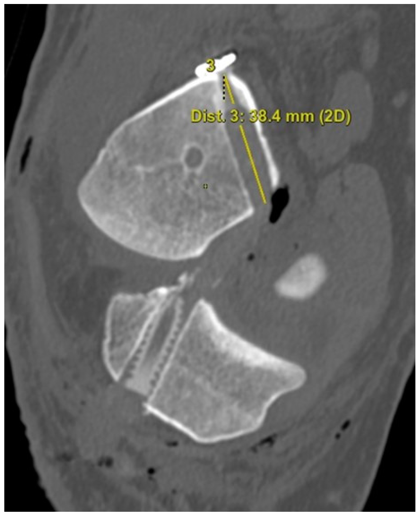 Medicina 59 01031 g004 Medicina 59 01031 g004