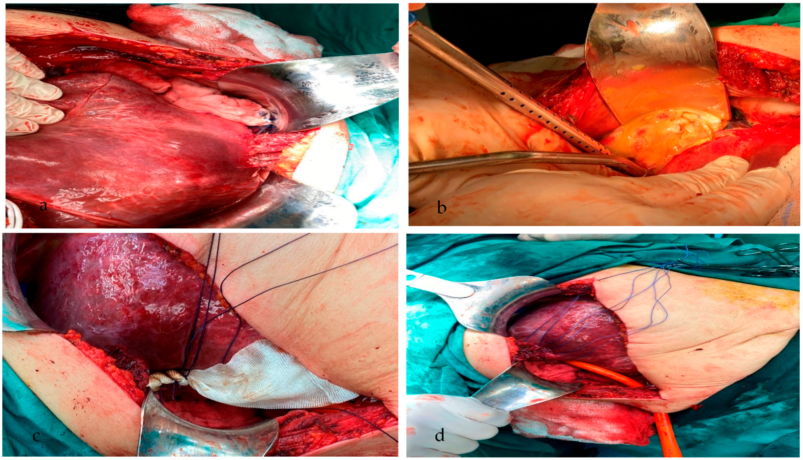 Medicina 59 01070 g002 Medicina 59 01070 g002