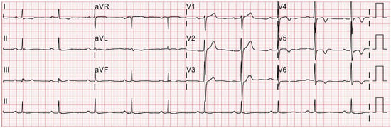 Preoperative and postoperative facial and chest signs of Case 2