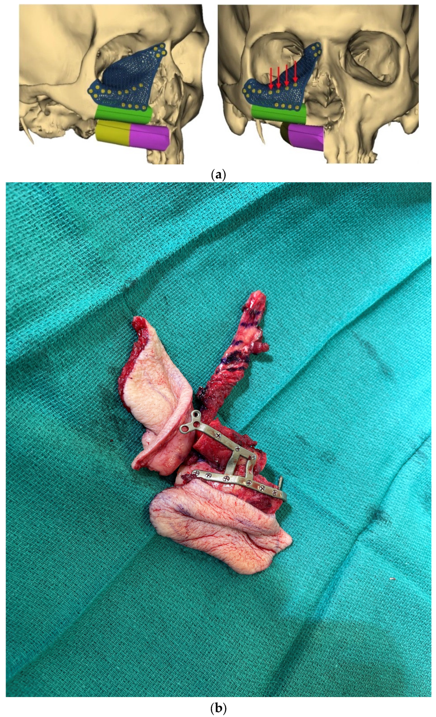 Medicina 59 01194 g004 Medicina 59 01194 g004