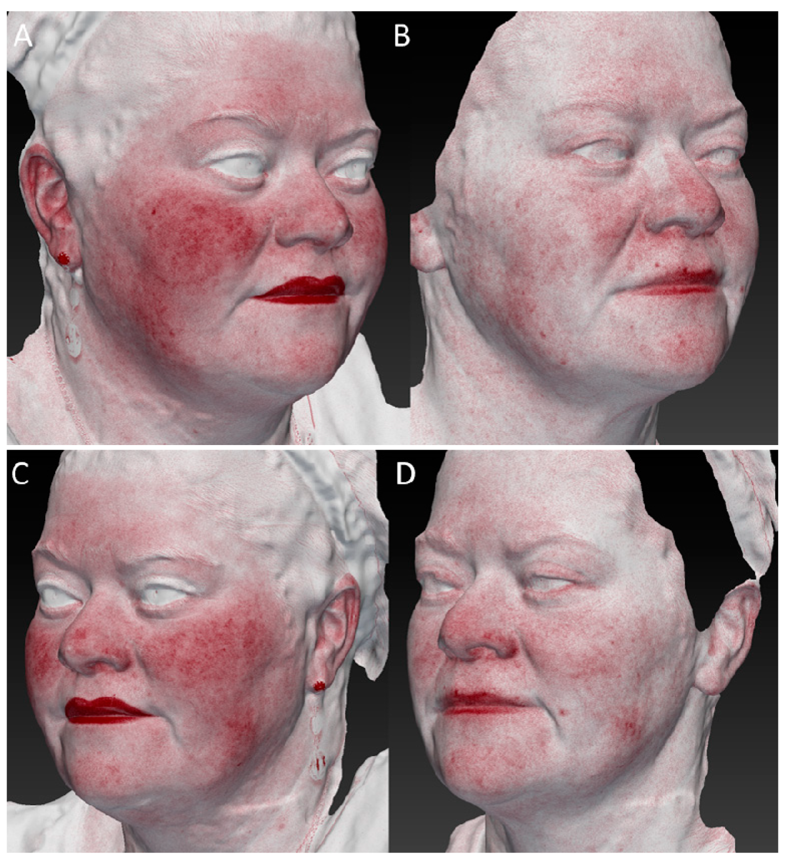 Medicina 59 01245 g005 Medicina 59 01245 g005