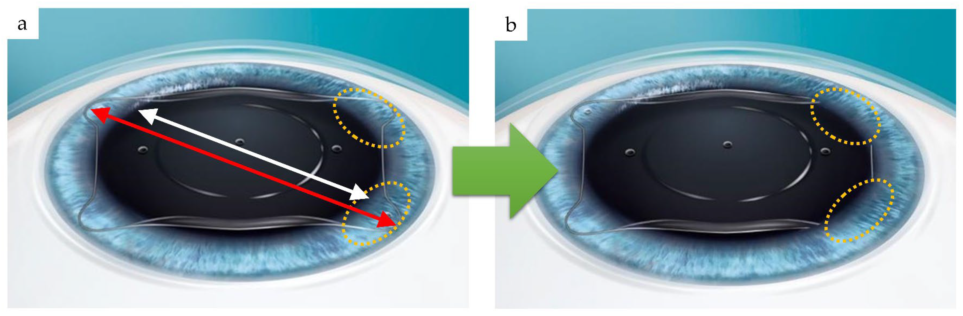 Medicina 59 01282 g005 Medicina 59 01282 g005