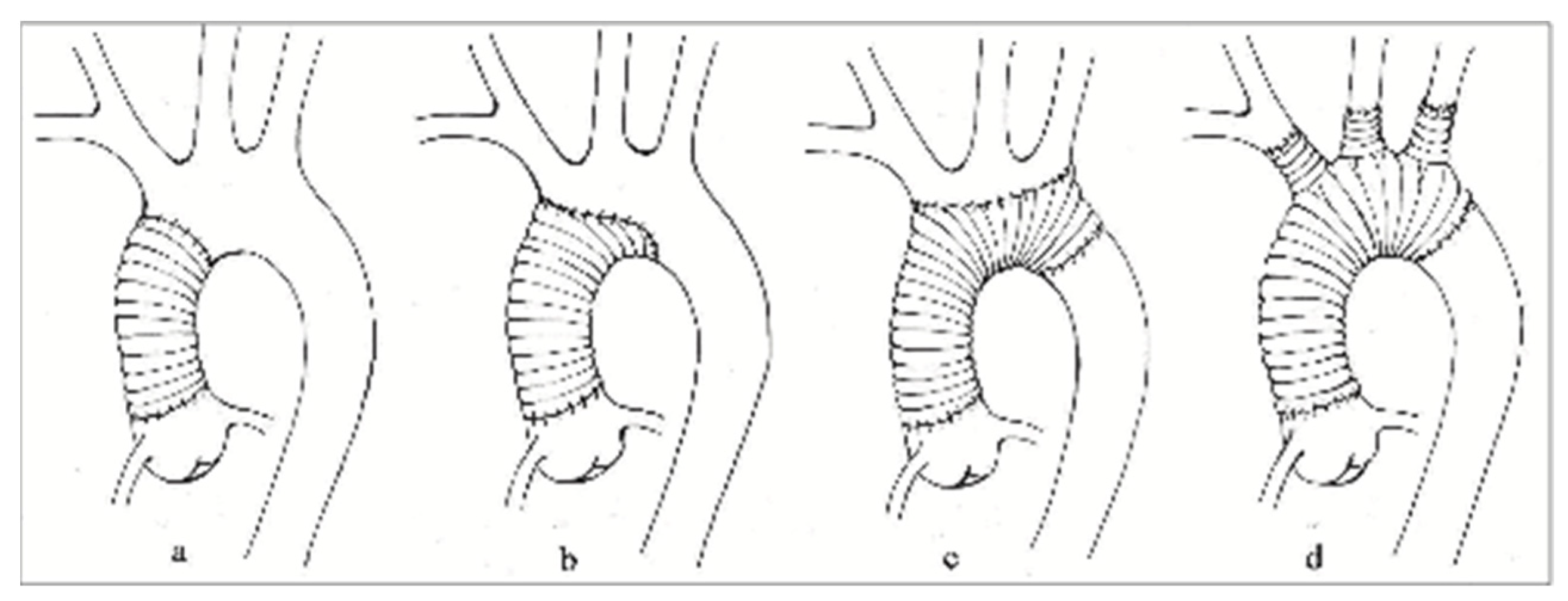 Medicina 59 01365 g001 Medicina 59 01365 g001