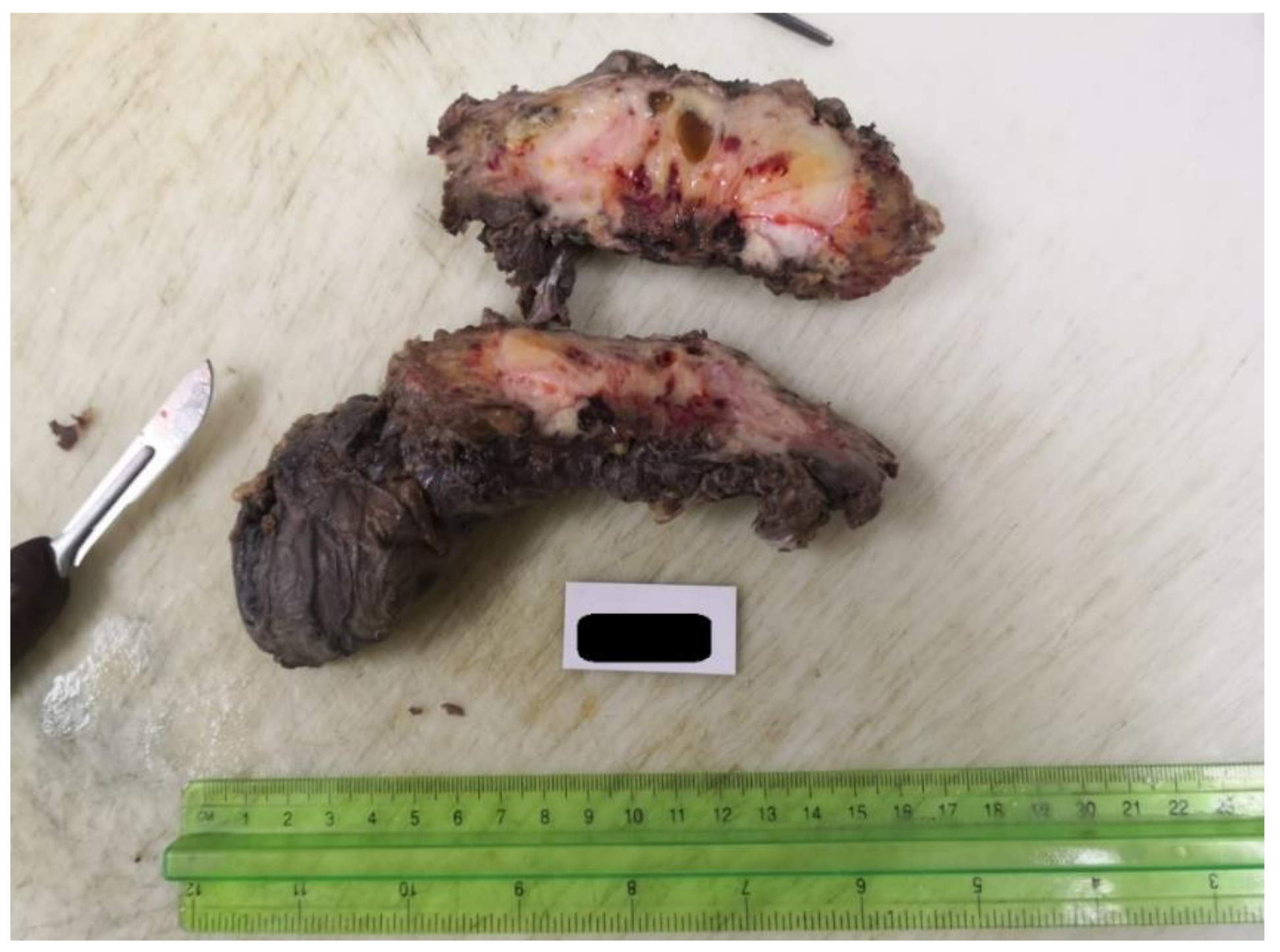 Medicina 59 01515 g002 Medicina 59 01515 g002