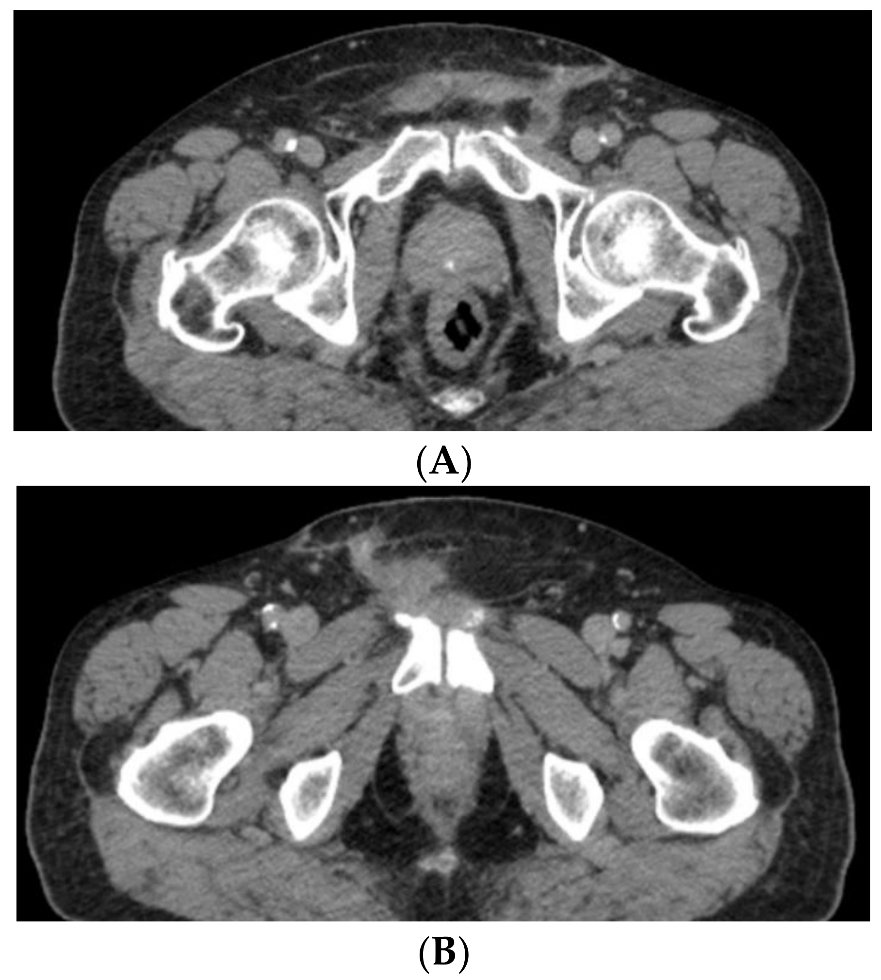 Medicina 59 01515 g006 Medicina 59 01515 g006