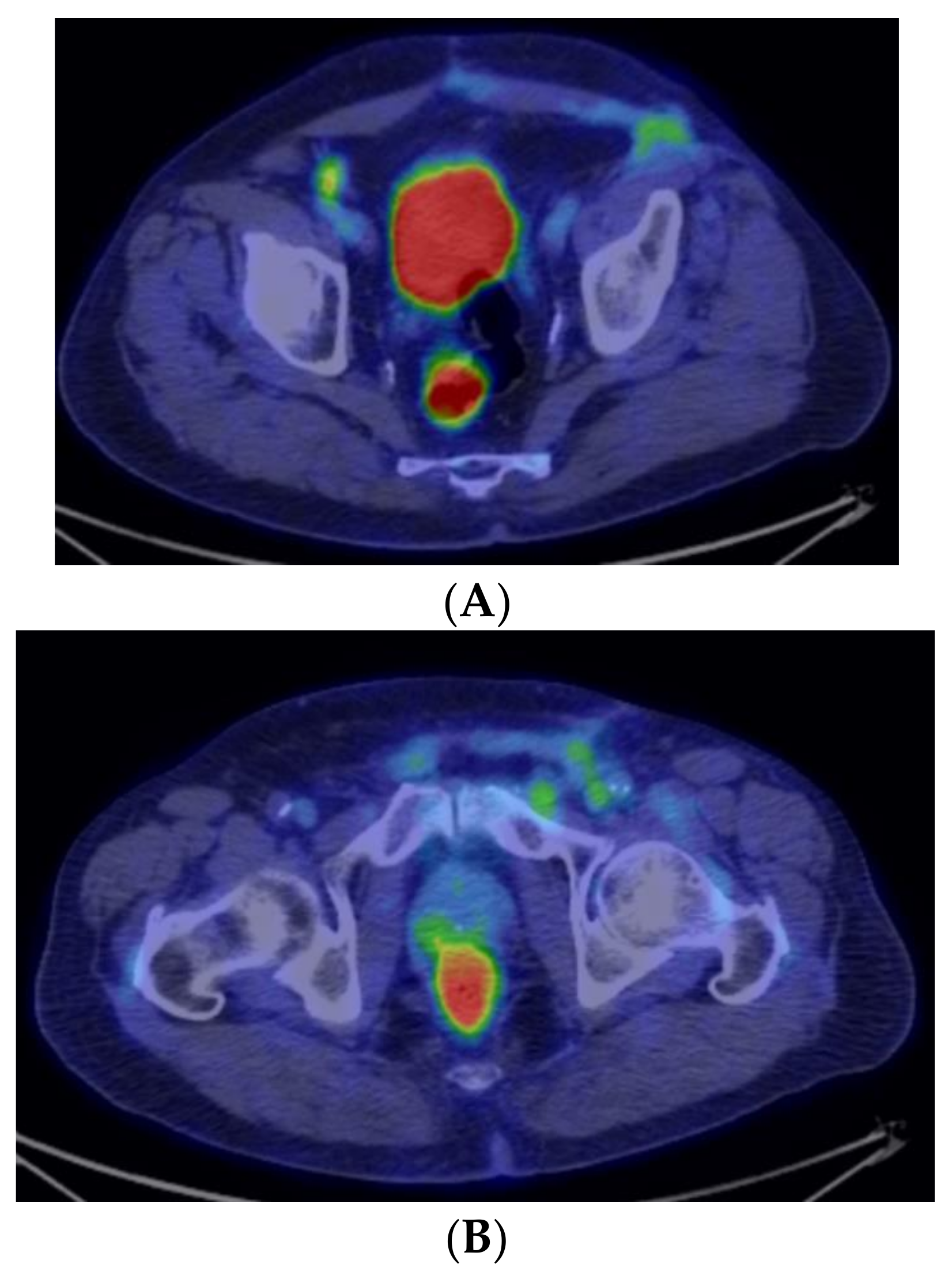 Medicina 59 01515 g007 Medicina 59 01515 g007