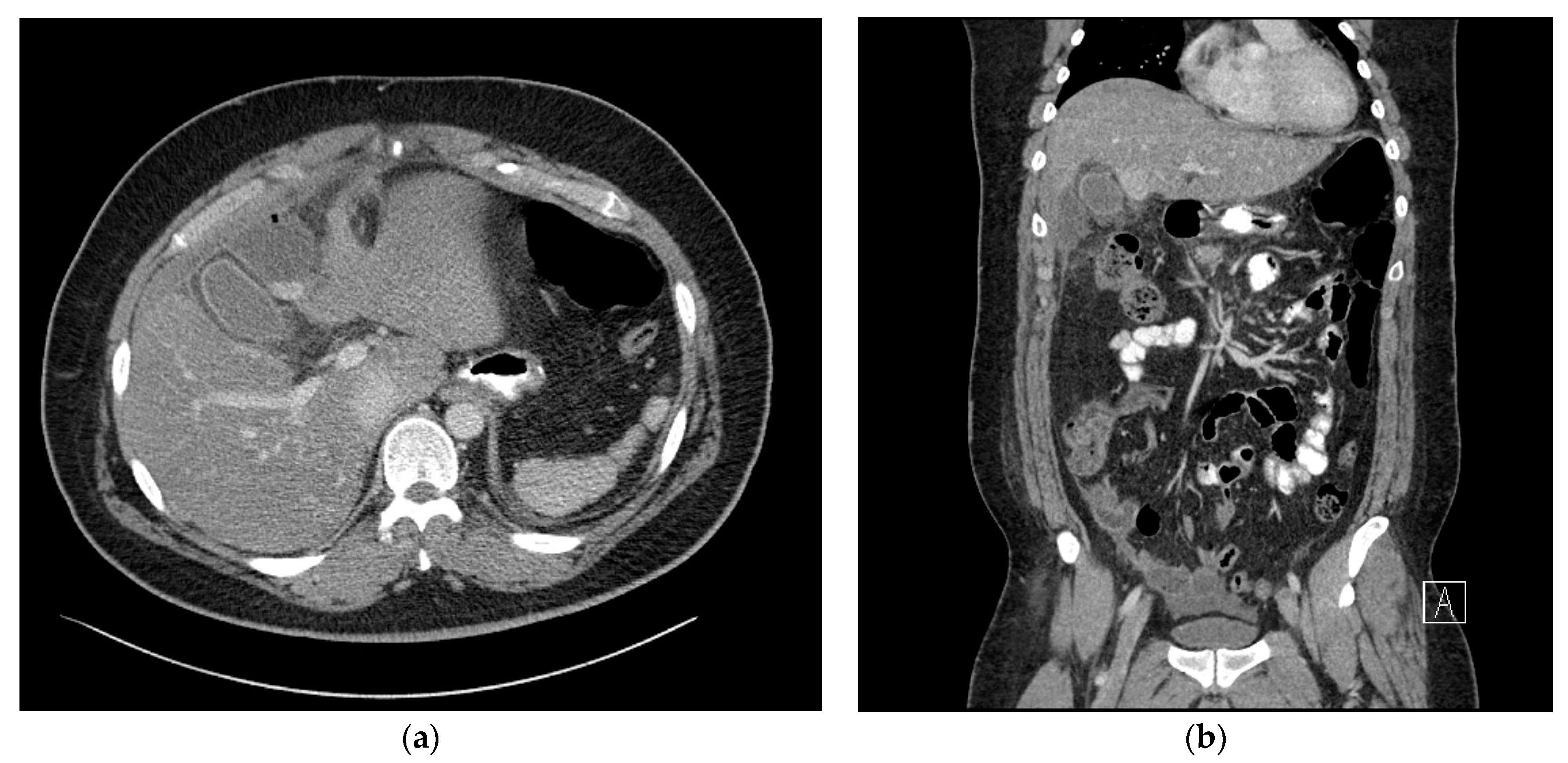 Medicina 59 01516 g002