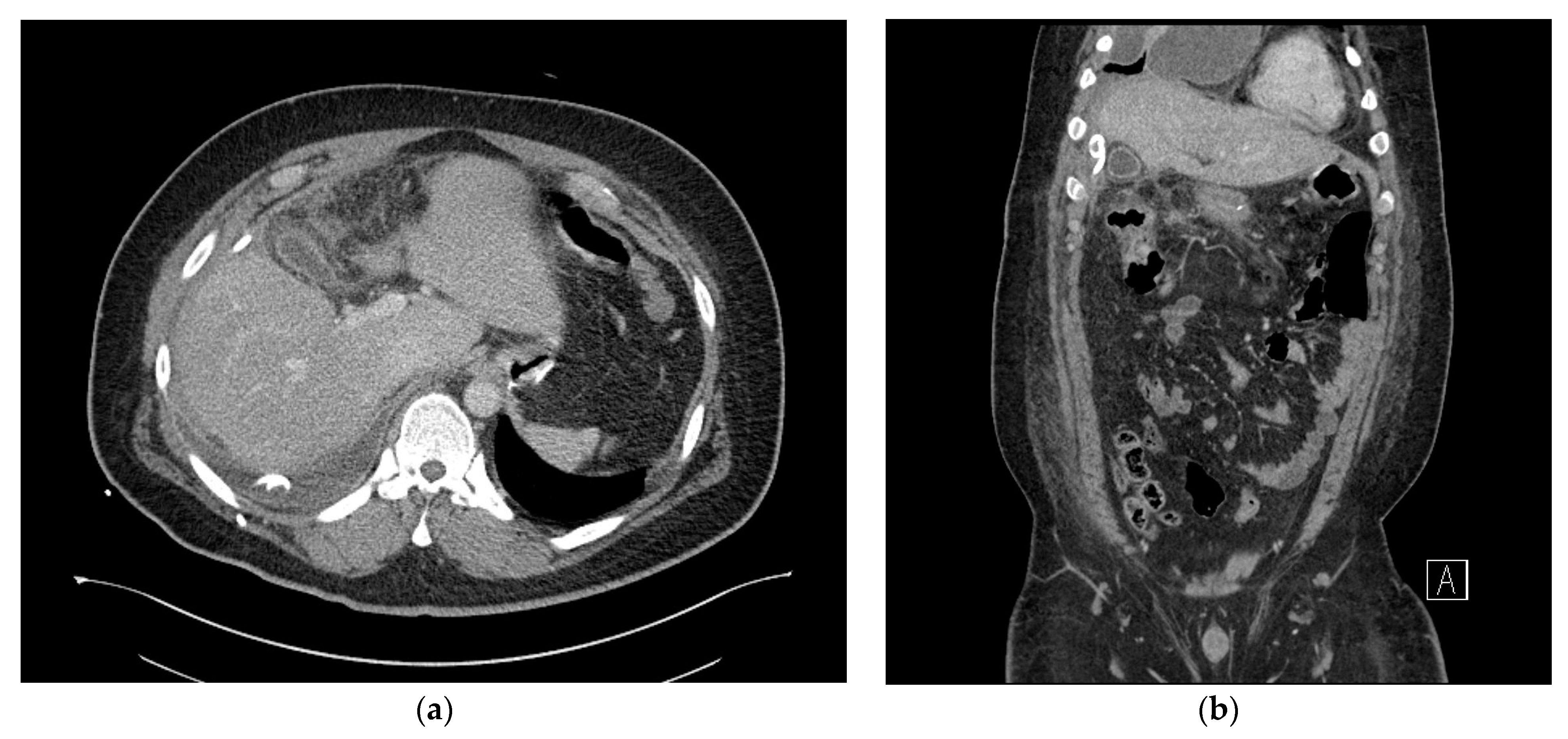 Medicina 59 01516 g004