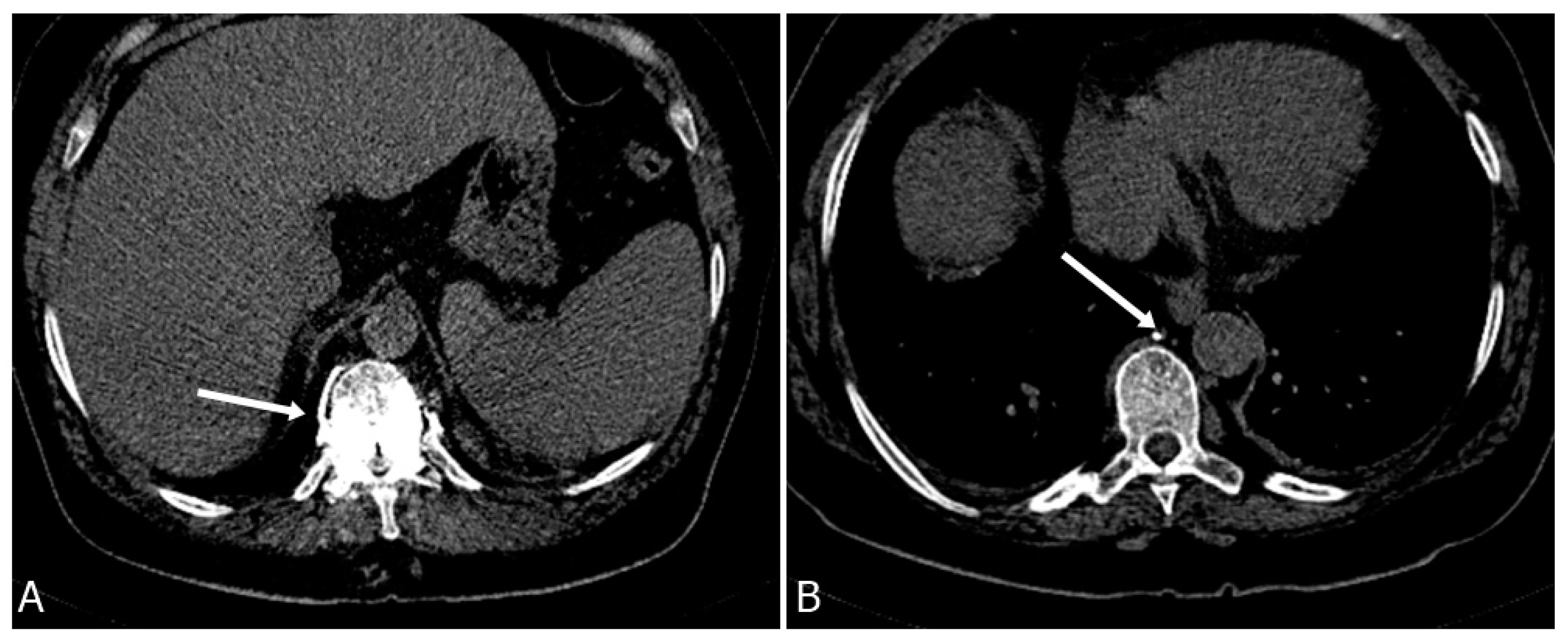Medicina 59 01536 g004