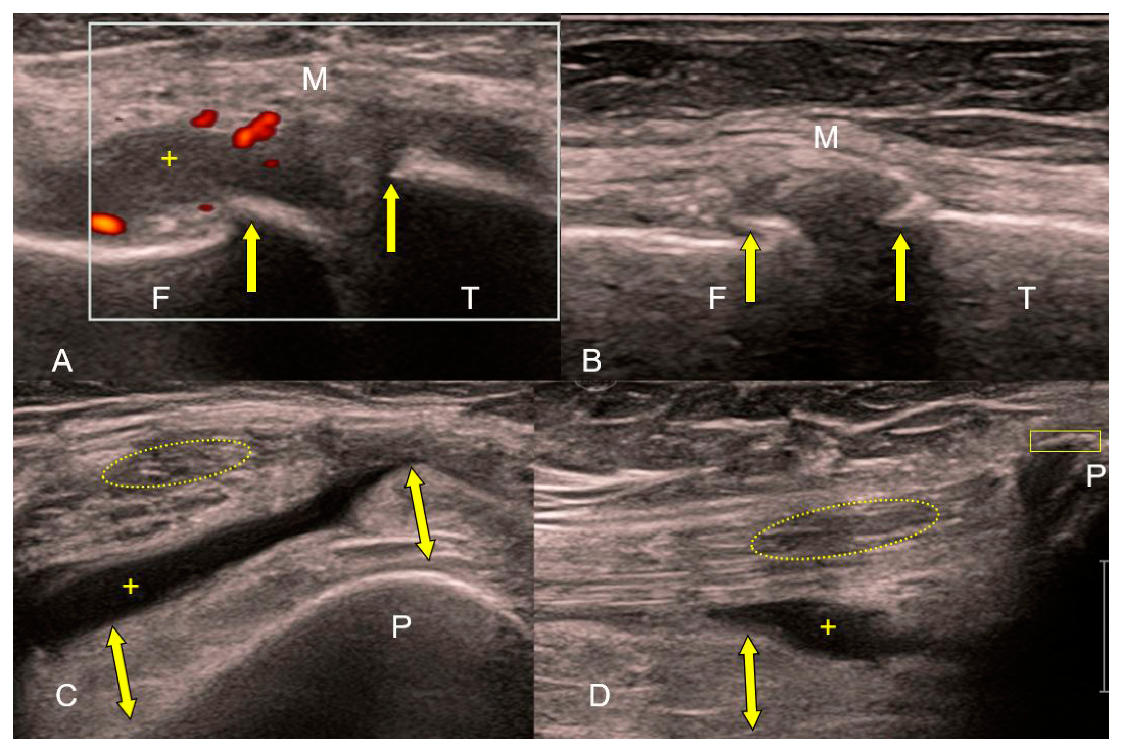 Medicina 59 01613 g003 Medicina 59 01613 g003