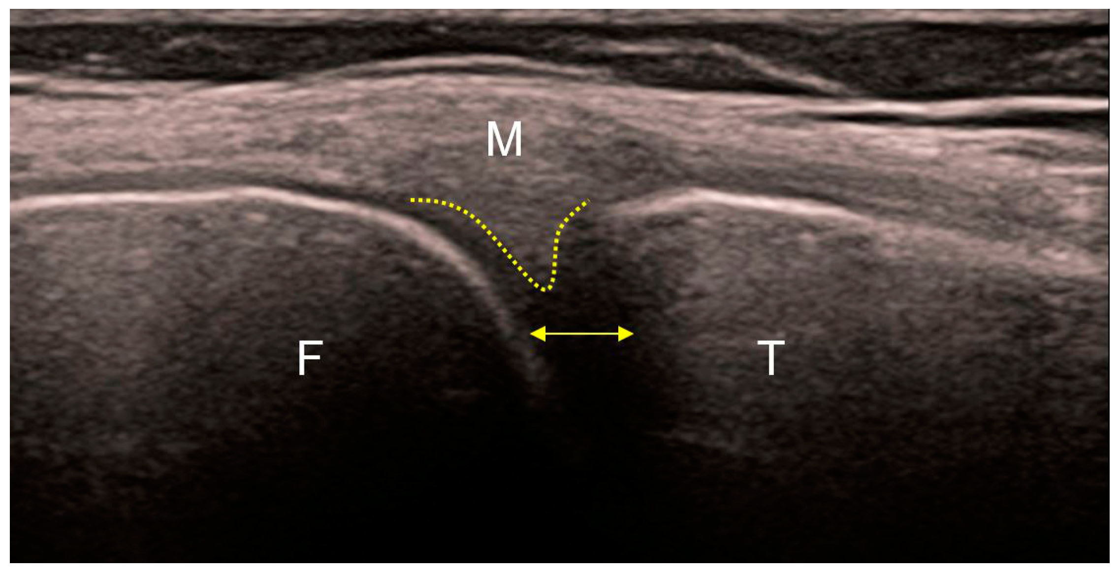 Medicina 59 01613 g004 Medicina 59 01613 g004