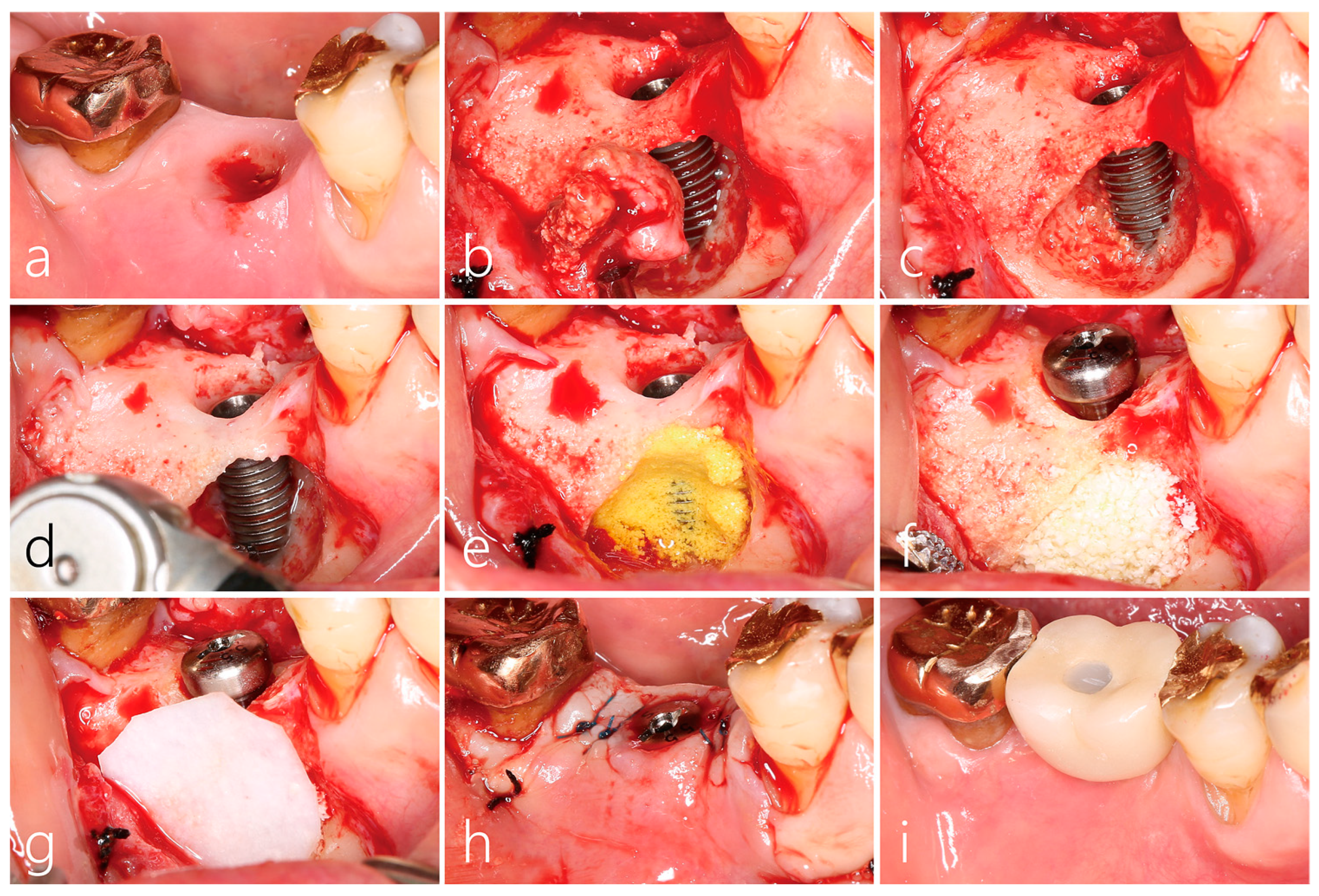 Medicina 59 01691 g003