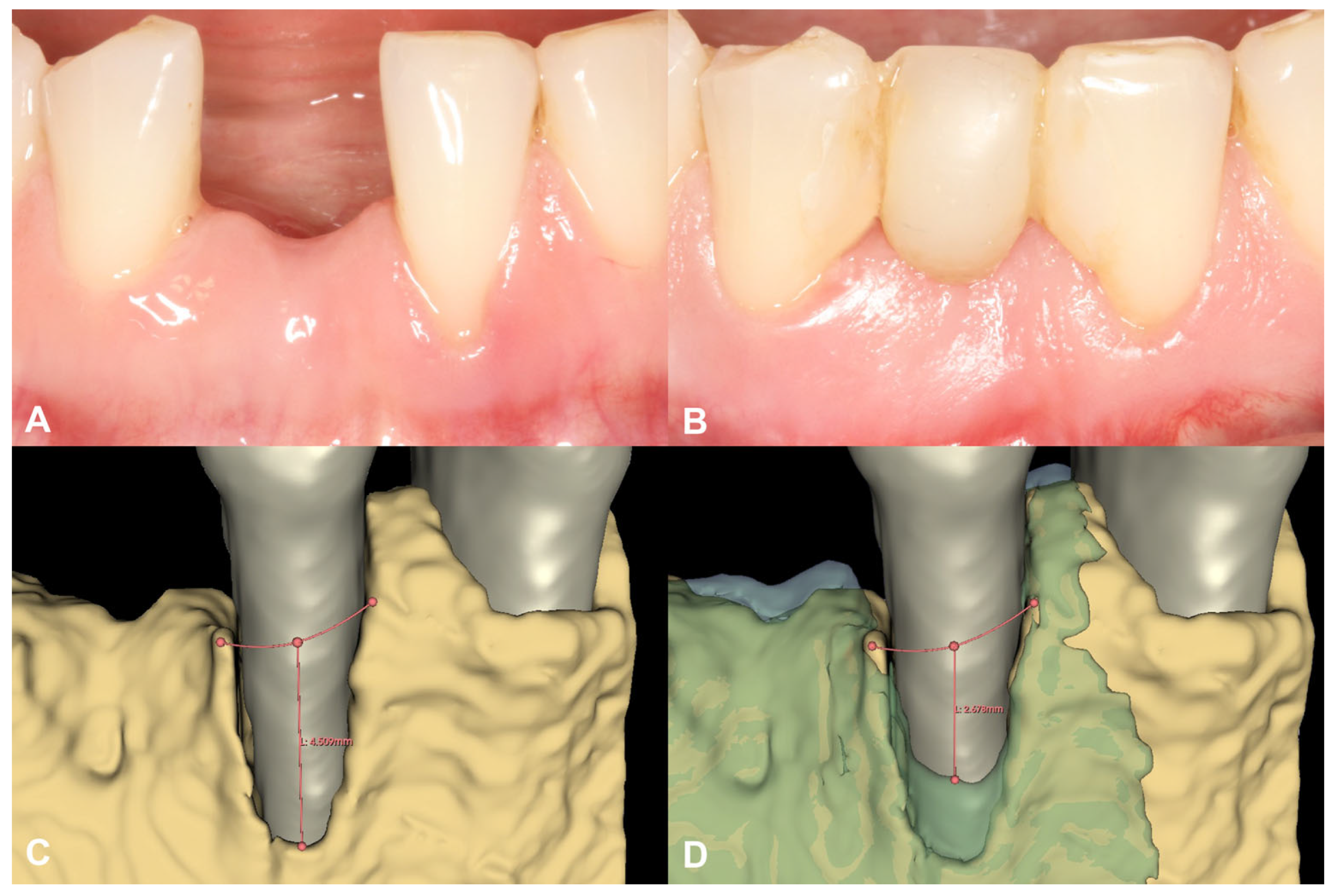 Medicina 59 01698 g004