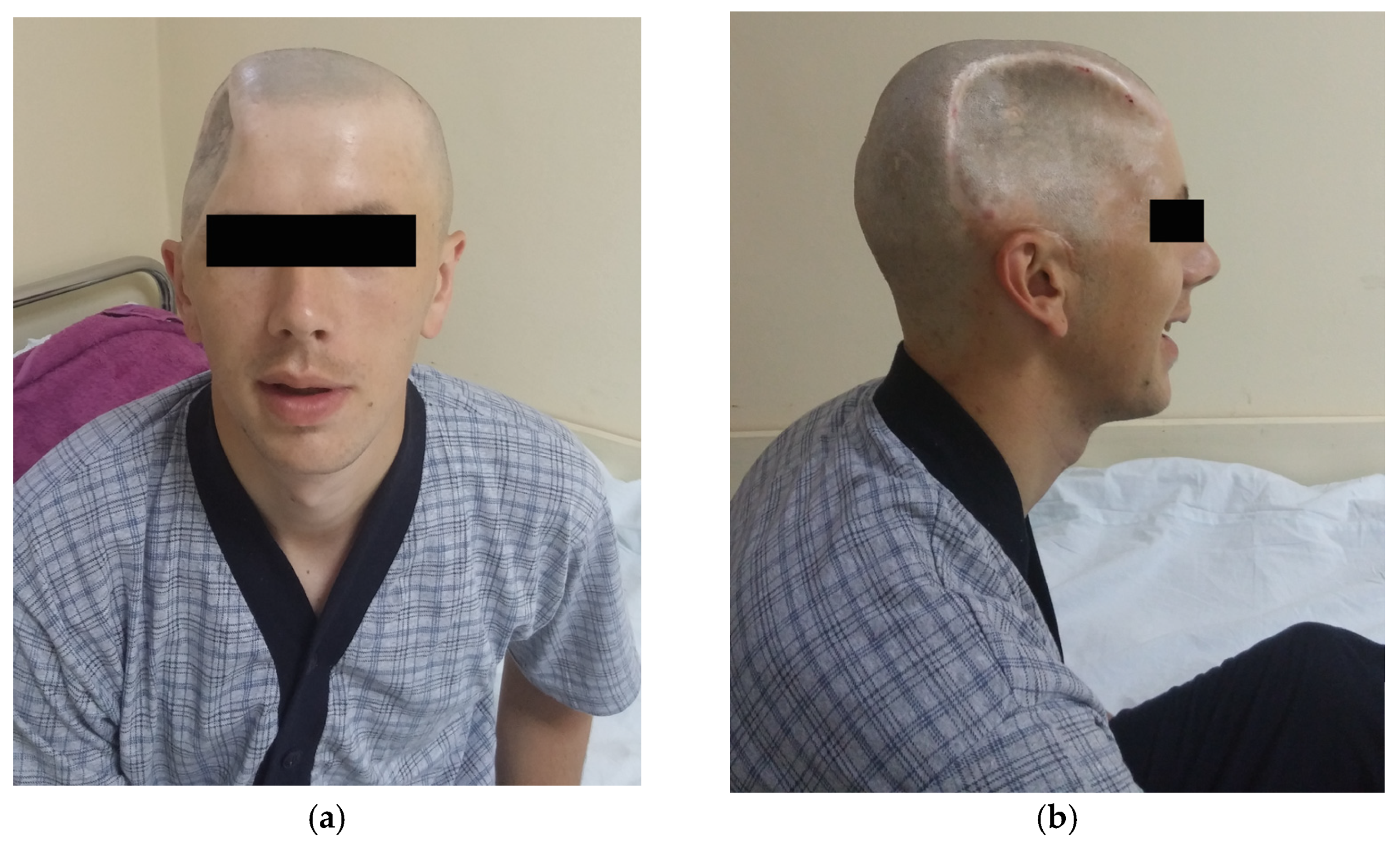 Medicina 59 01732 g004 Medicina 59 01732 g004