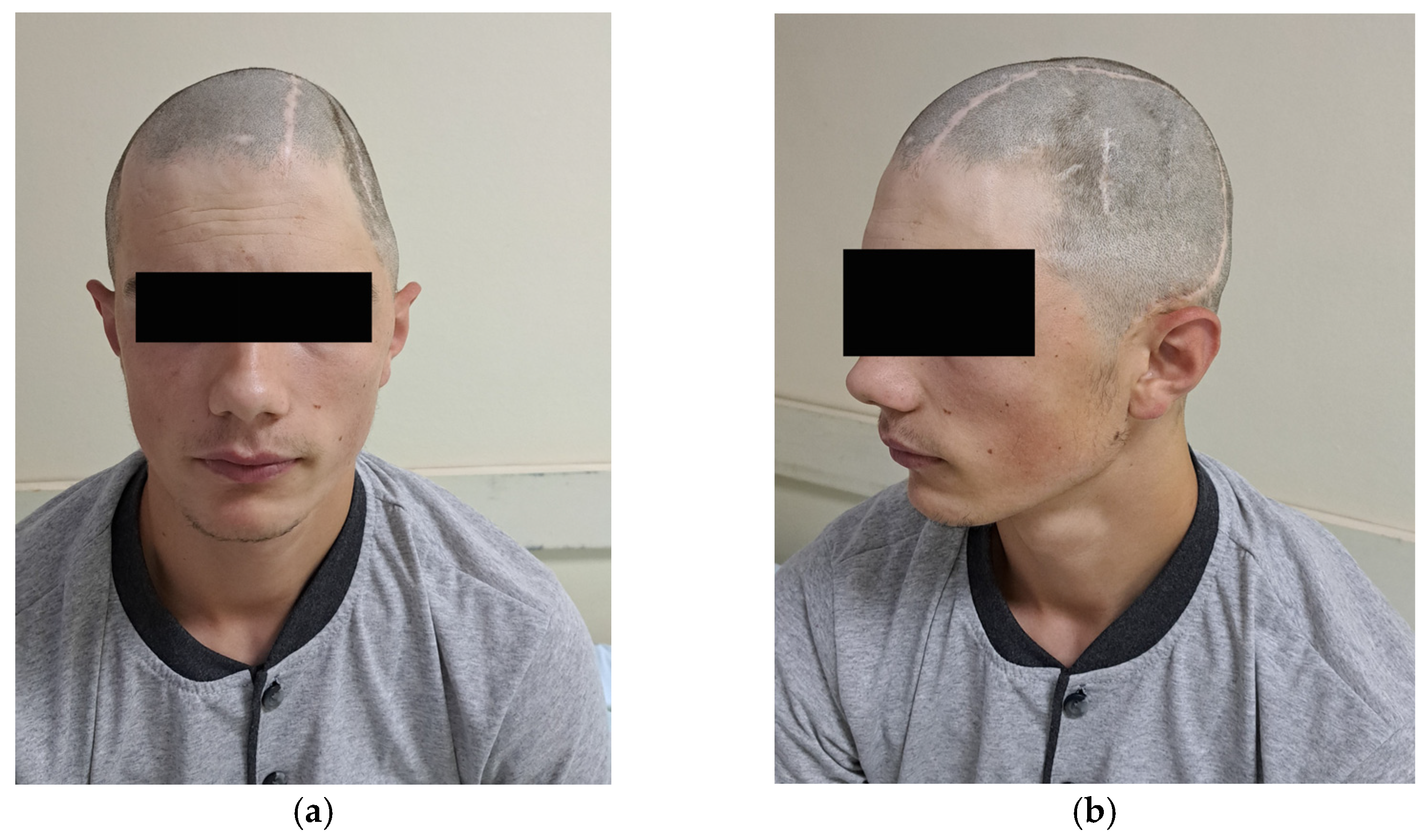 Medicina 59 01732 g005 Medicina 59 01732 g005