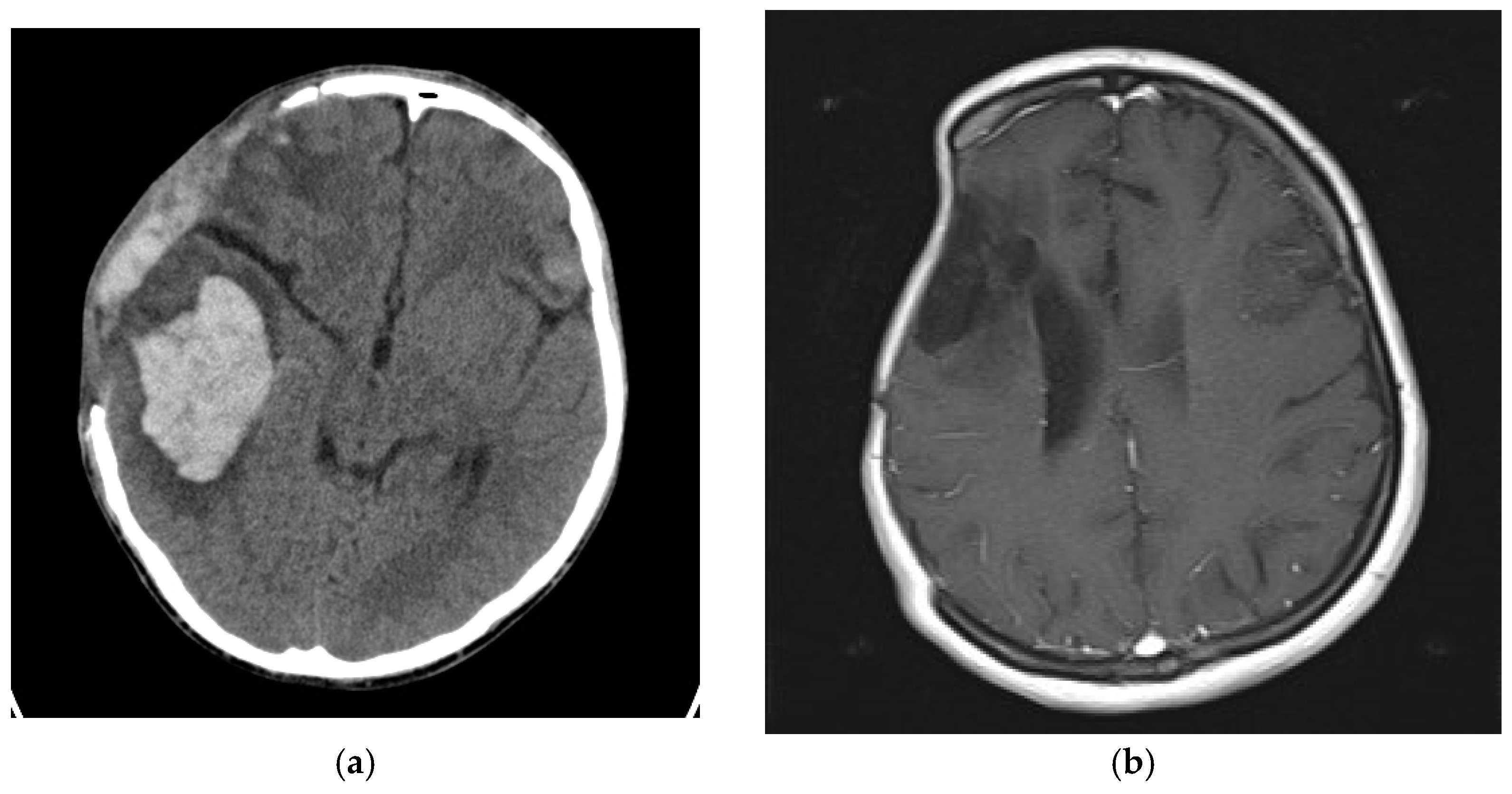 Medicina 59 01732 g007 Medicina 59 01732 g007