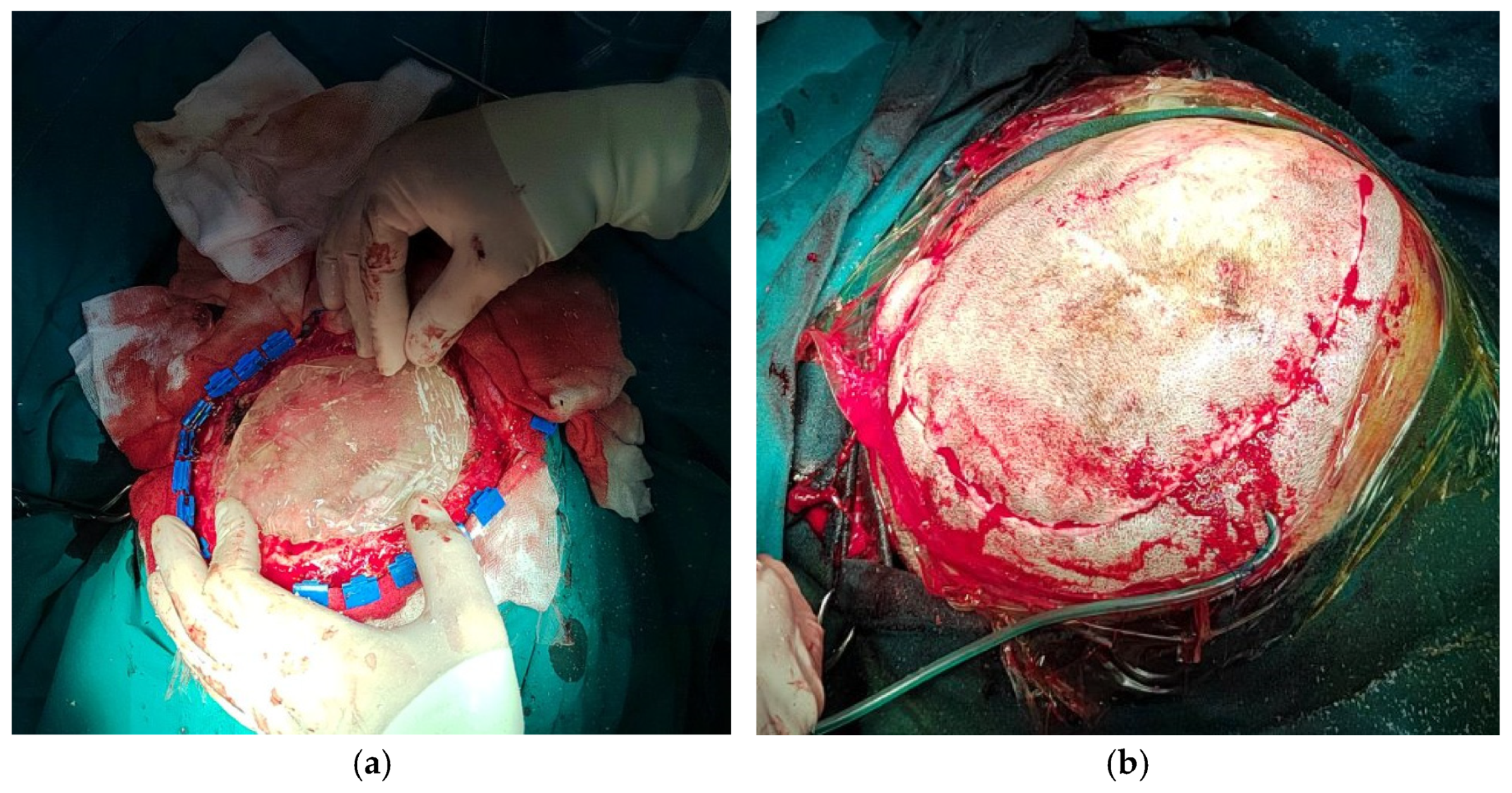 Medicina 59 01732 g009 Medicina 59 01732 g009