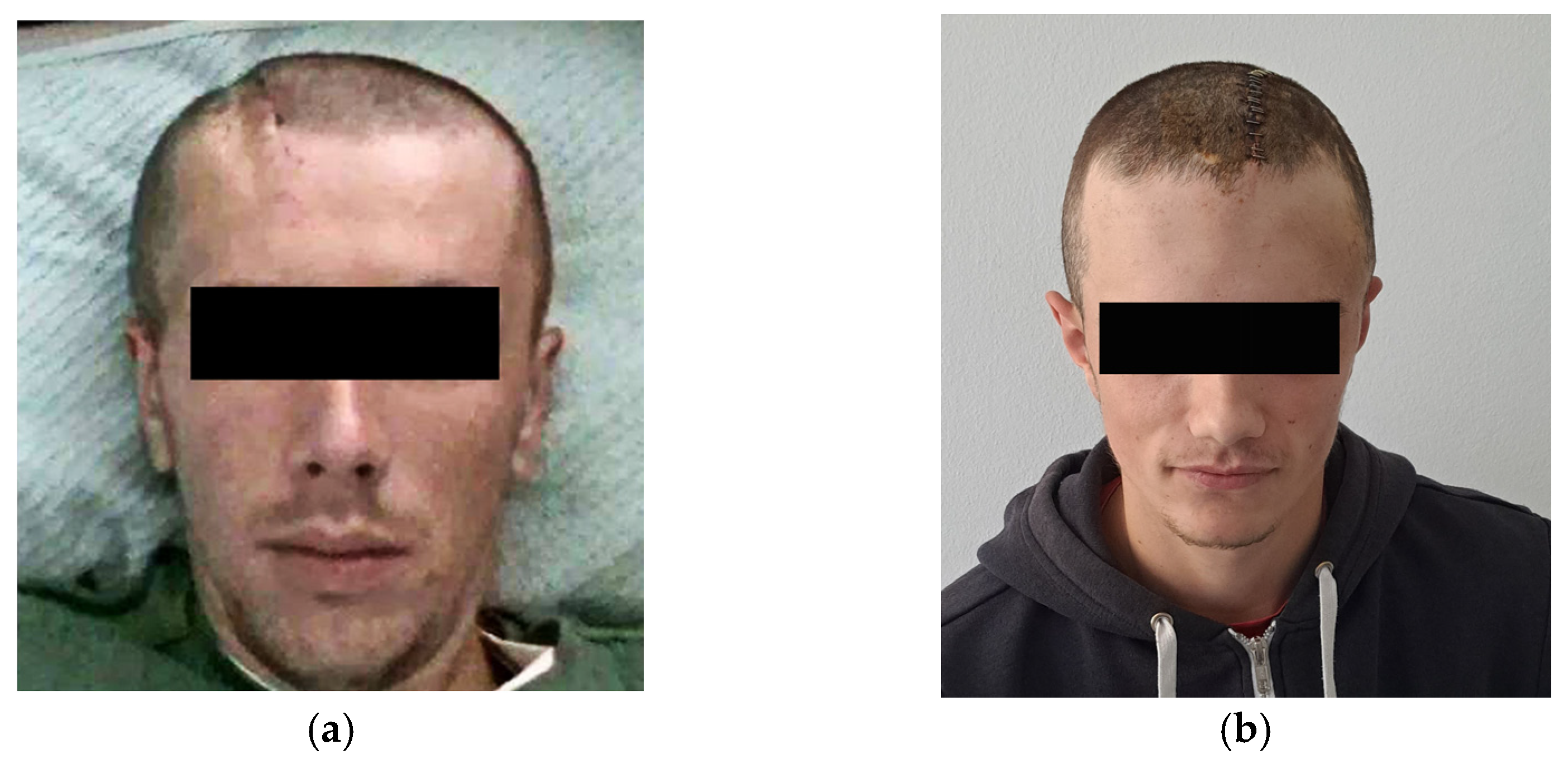 Medicina 59 01732 g010 Medicina 59 01732 g010