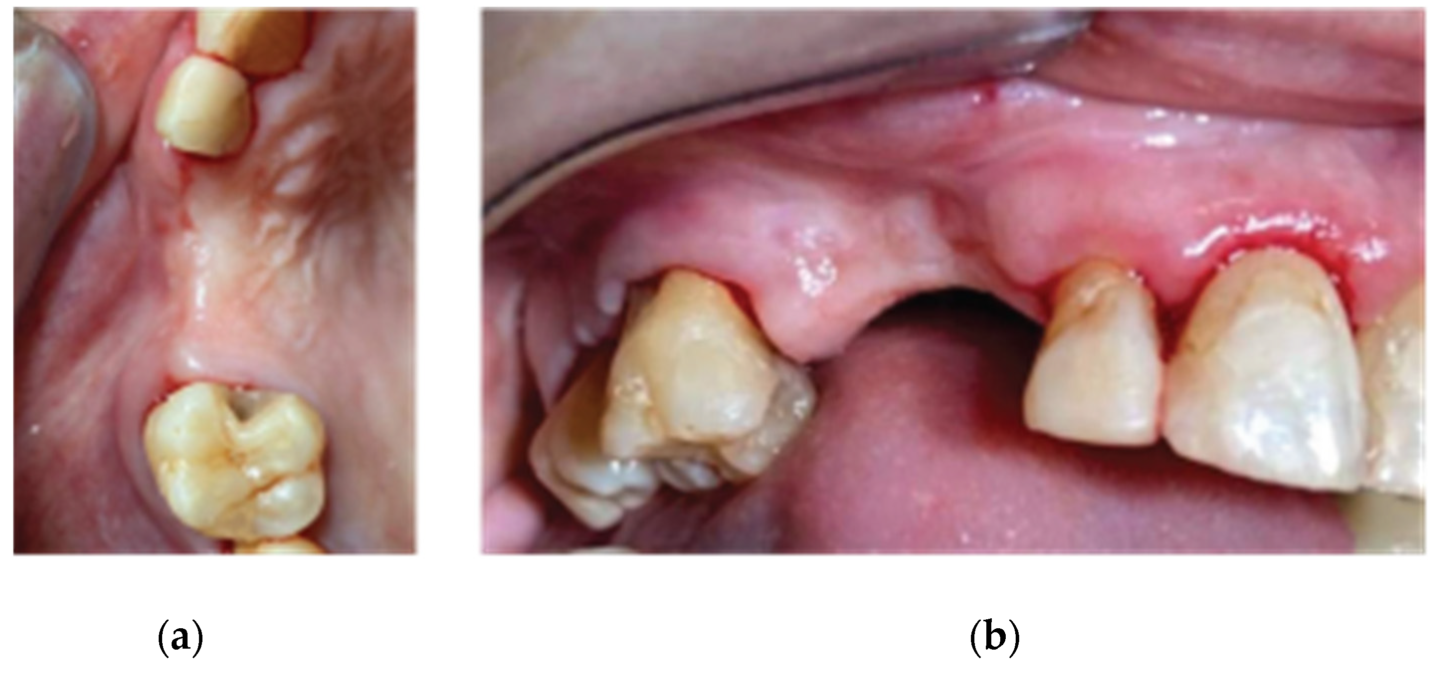 Medicina 59 01994 g002 Medicina 59 01994 g002