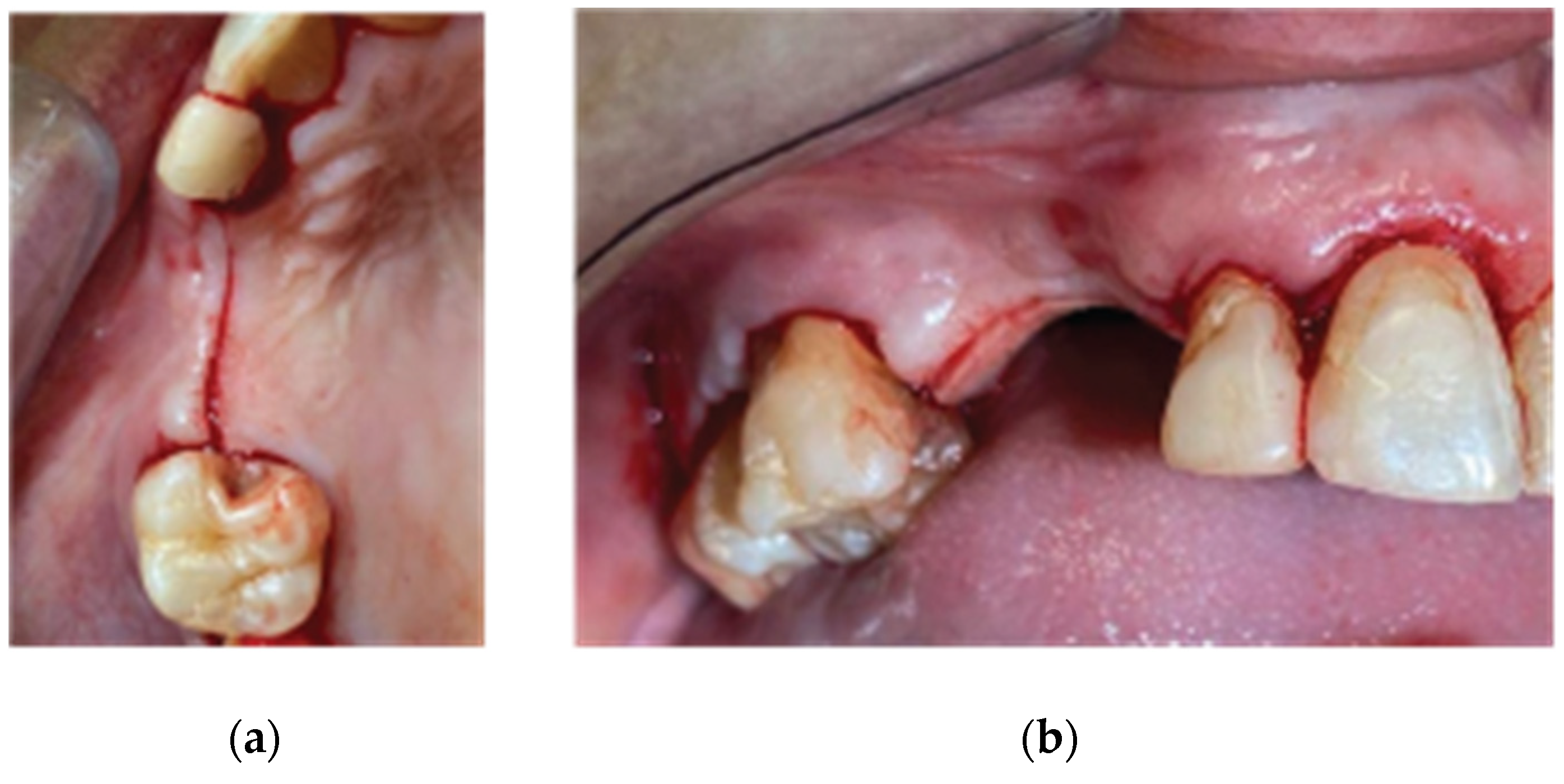 Medicina 59 01994 g003 Medicina 59 01994 g003