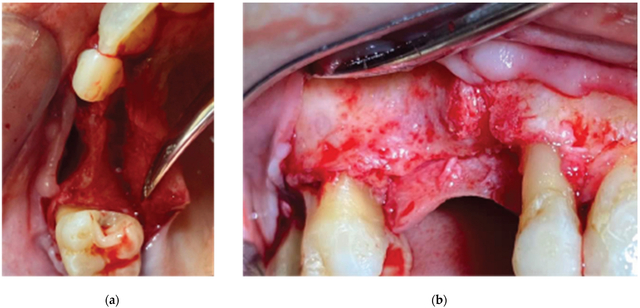 Medicina 59 01994 g004 Medicina 59 01994 g004