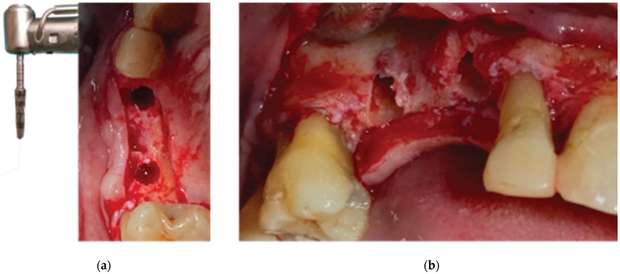 Medicina 59 01994 g005 Medicina 59 01994 g005