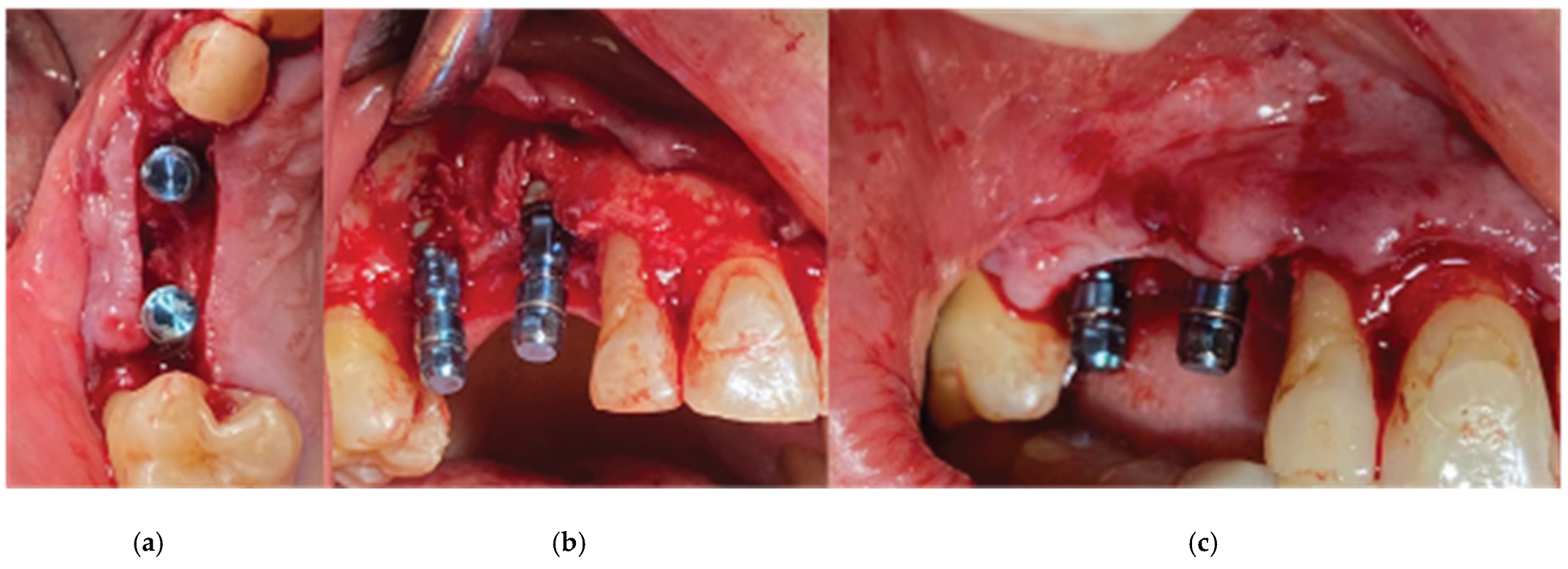 Medicina 59 01994 g006 Medicina 59 01994 g006