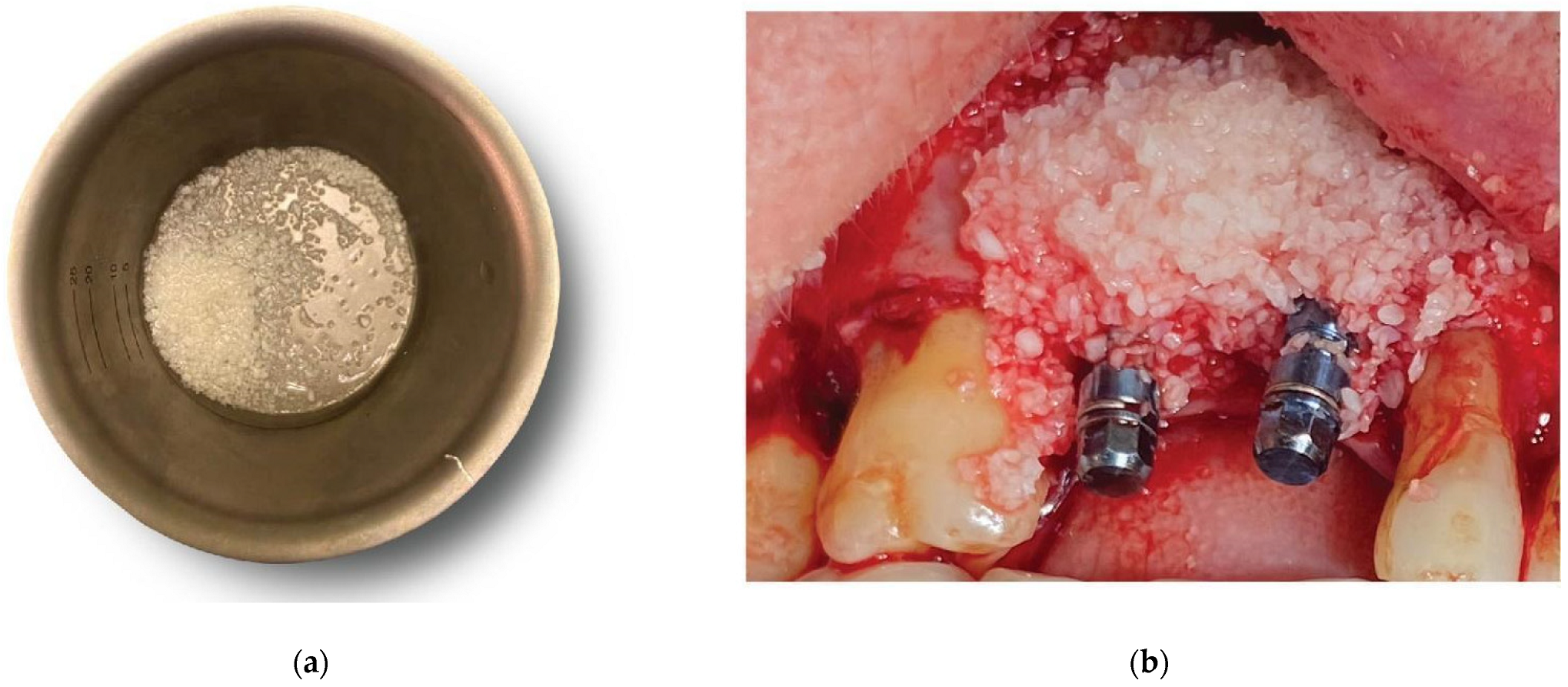 Medicina 59 01994 g008 Medicina 59 01994 g008