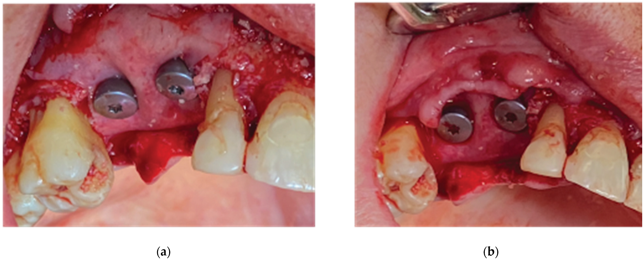 Medicina 59 01994 g009 Medicina 59 01994 g009