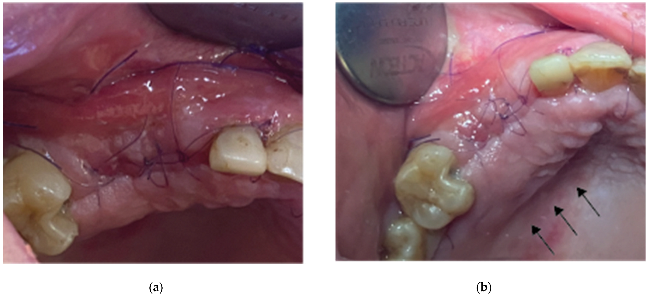 Medicina 59 01994 g010 Medicina 59 01994 g010