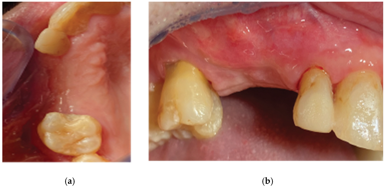 Medicina 59 01994 g011 Medicina 59 01994 g011