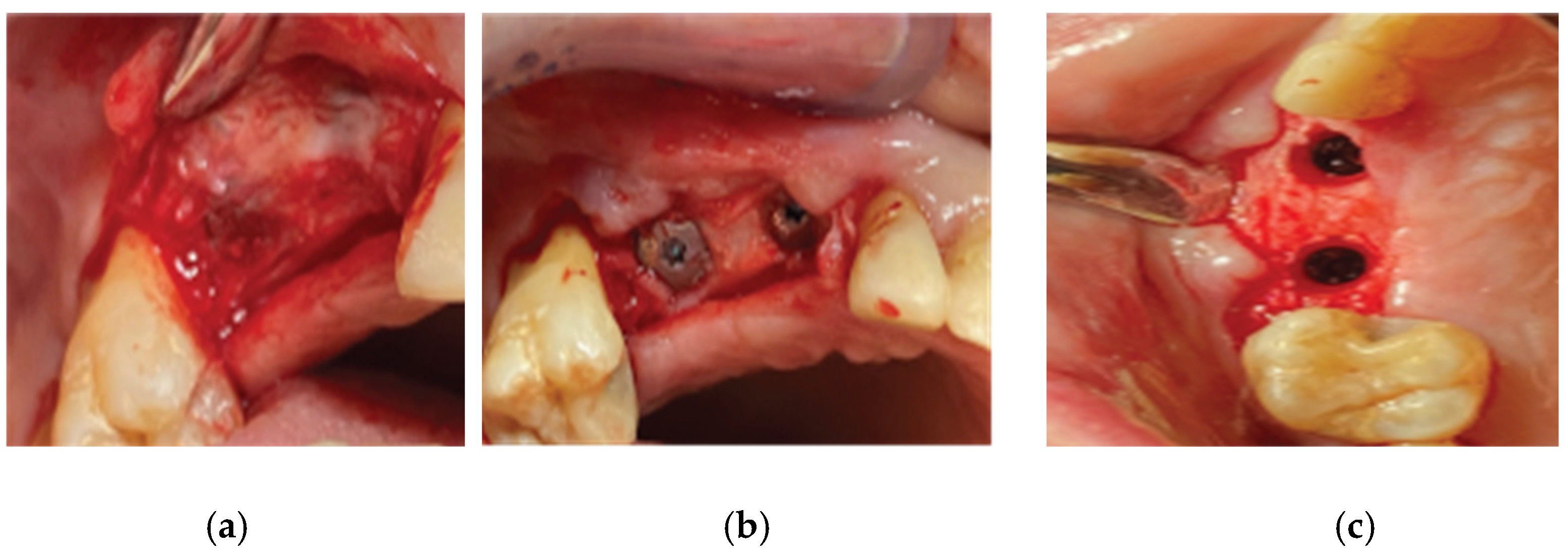 Medicina 59 01994 g014 Medicina 59 01994 g014