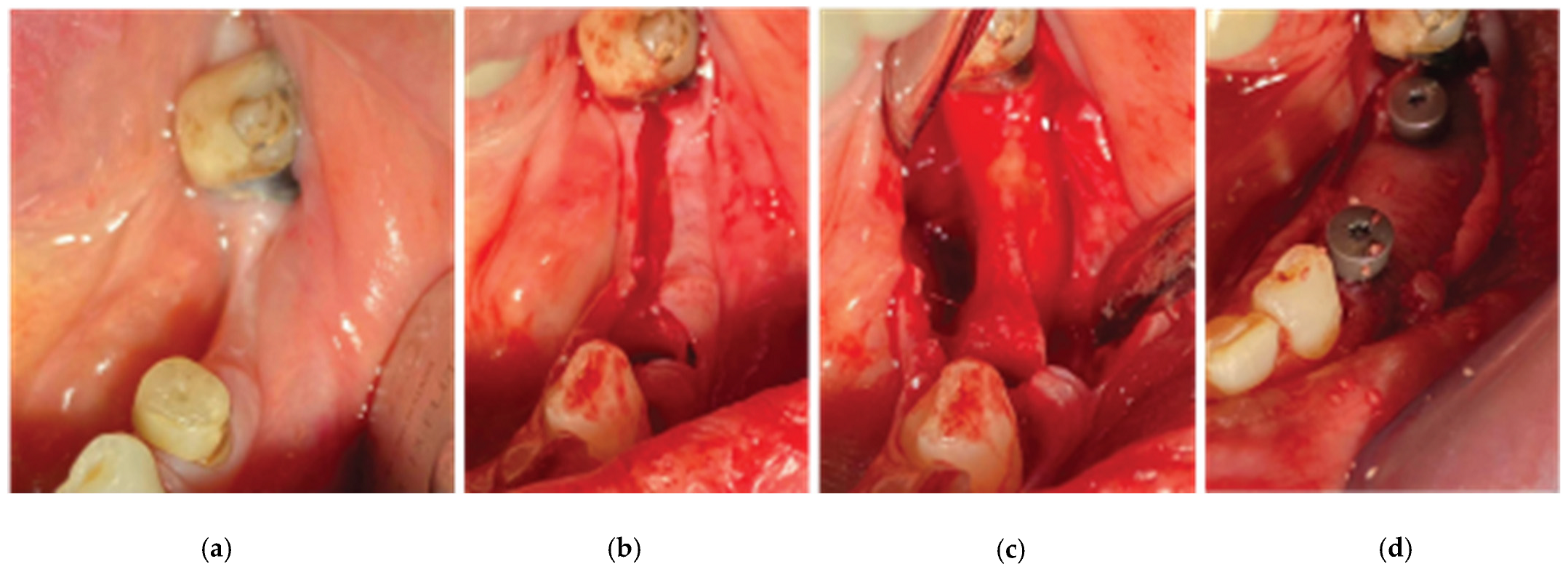 Medicina 59 01994 g017 Medicina 59 01994 g017