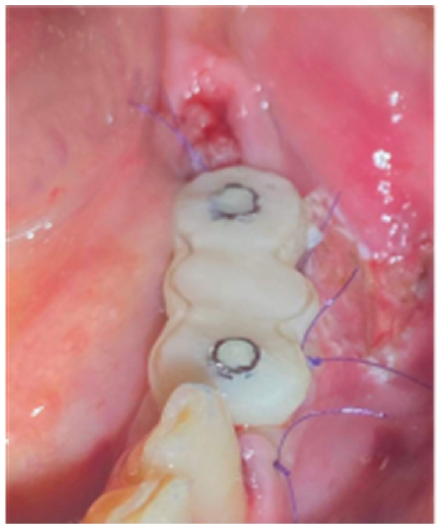 Medicina 59 01994 g020 Medicina 59 01994 g020