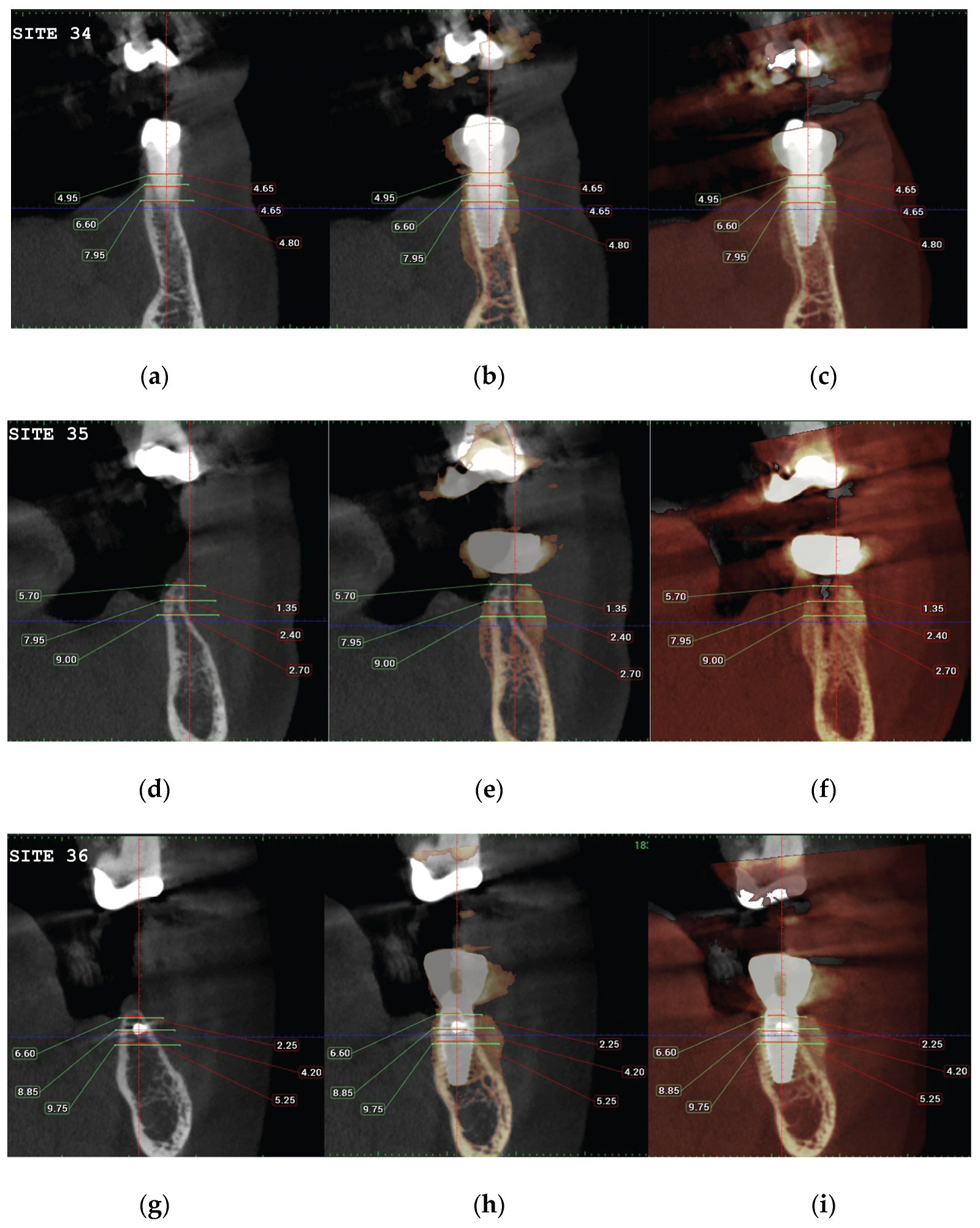Medicina 59 01994 g022 Medicina 59 01994 g022