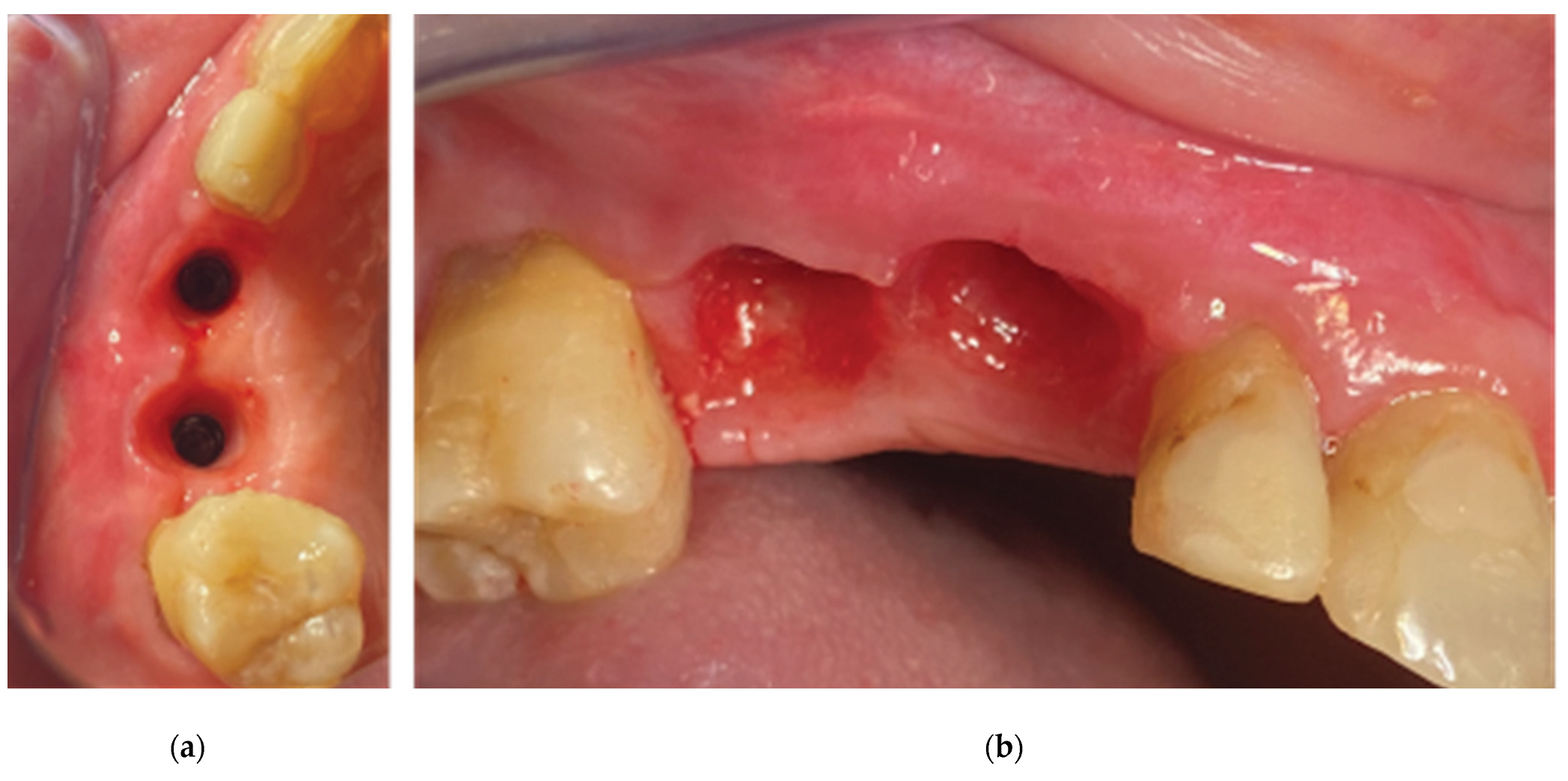 Medicina 59 01994 g024 Medicina 59 01994 g024