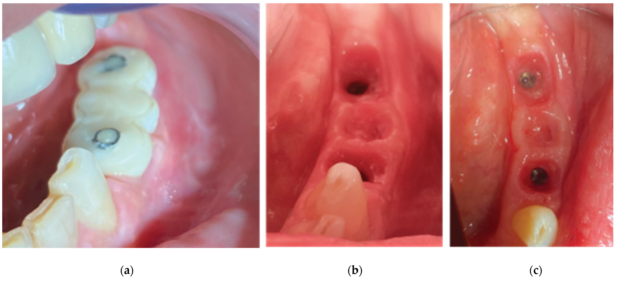 Medicina 59 01994 g025 Medicina 59 01994 g025