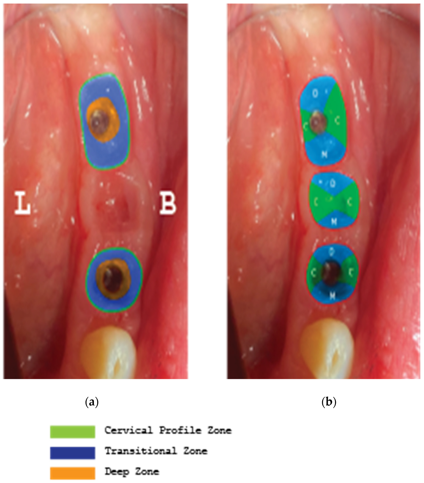 Medicina 59 01994 g027 Medicina 59 01994 g027