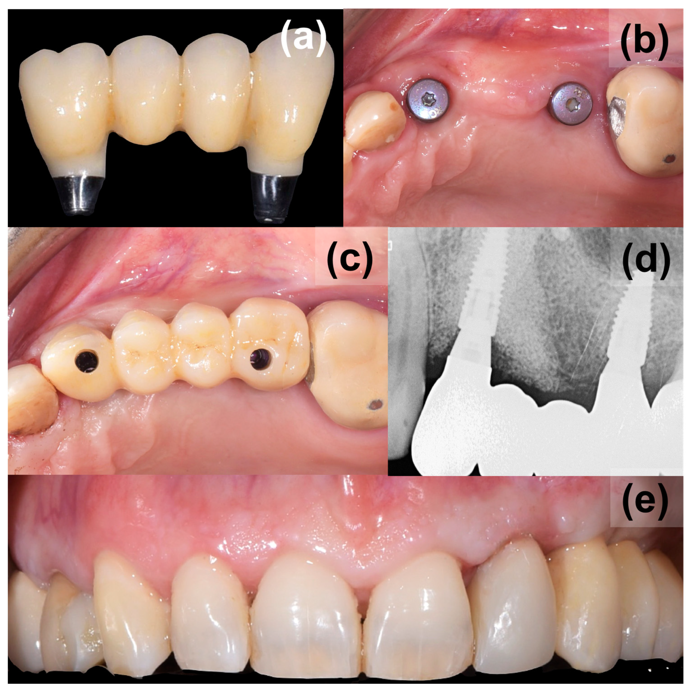 Medicina 59 02009 g005