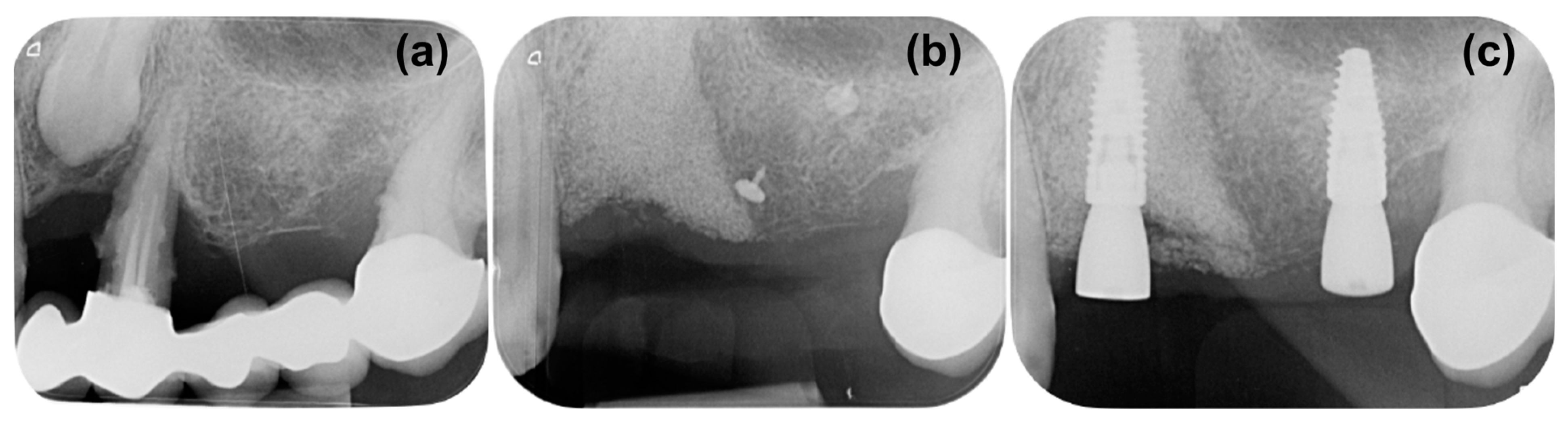 Medicina 59 02009 g006