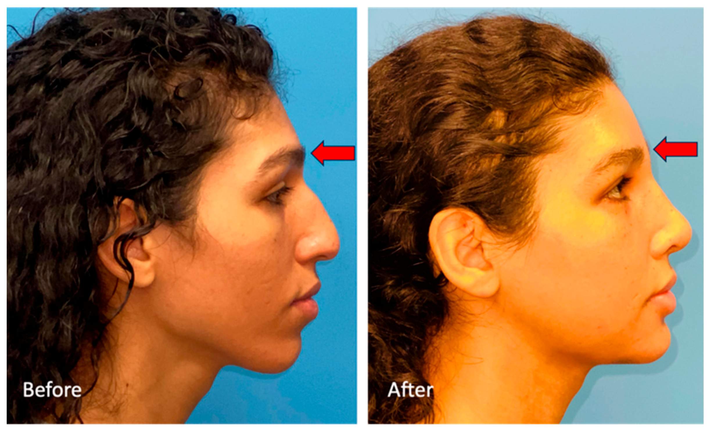 Medicina 59 02070 g004 Medicina 59 02070 g004