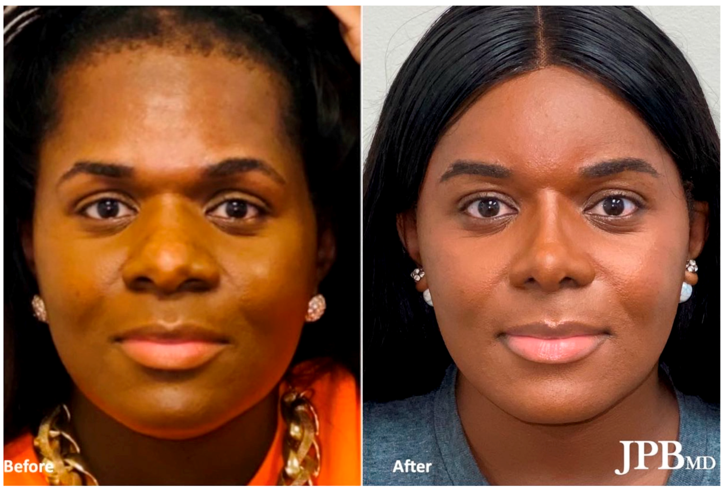 Medicina 59 02070 g005 Medicina 59 02070 g005