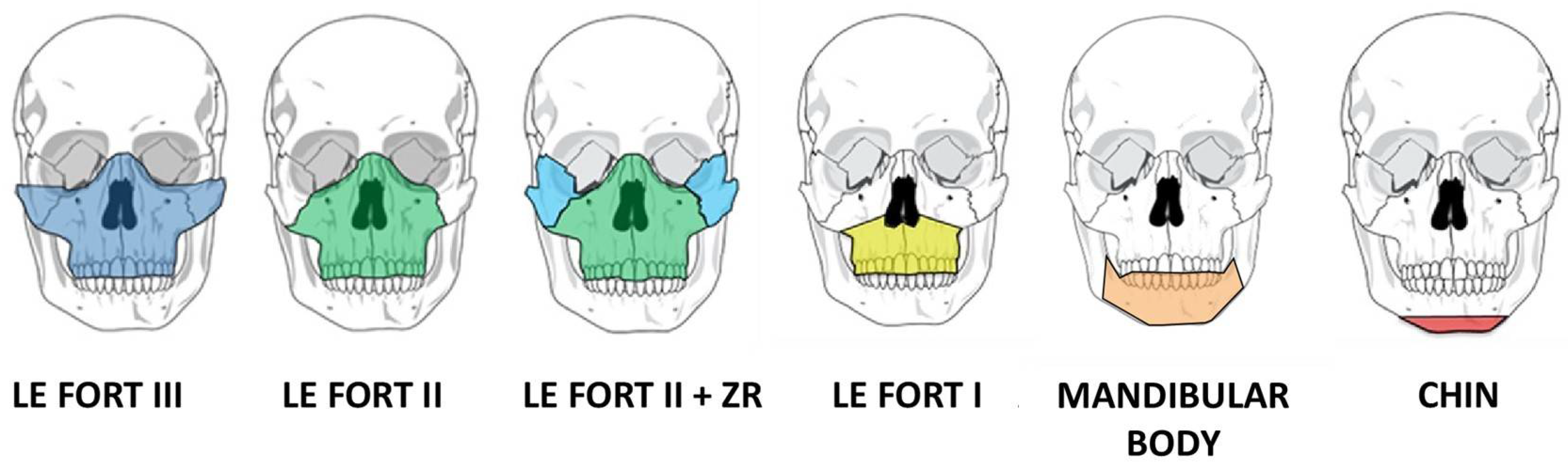 Frontiers  Electrical Stimulation of Acute Fractures: A Narrative