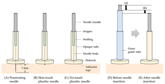 PDF] Relief of chronic neck and shoulder pain by manual acupuncture to  tender points--a sham-controlled randomized trial.