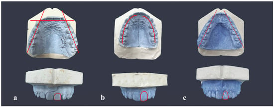 Medicina | Free Full-Text | Correlation Theory of the Maxillary Central ...