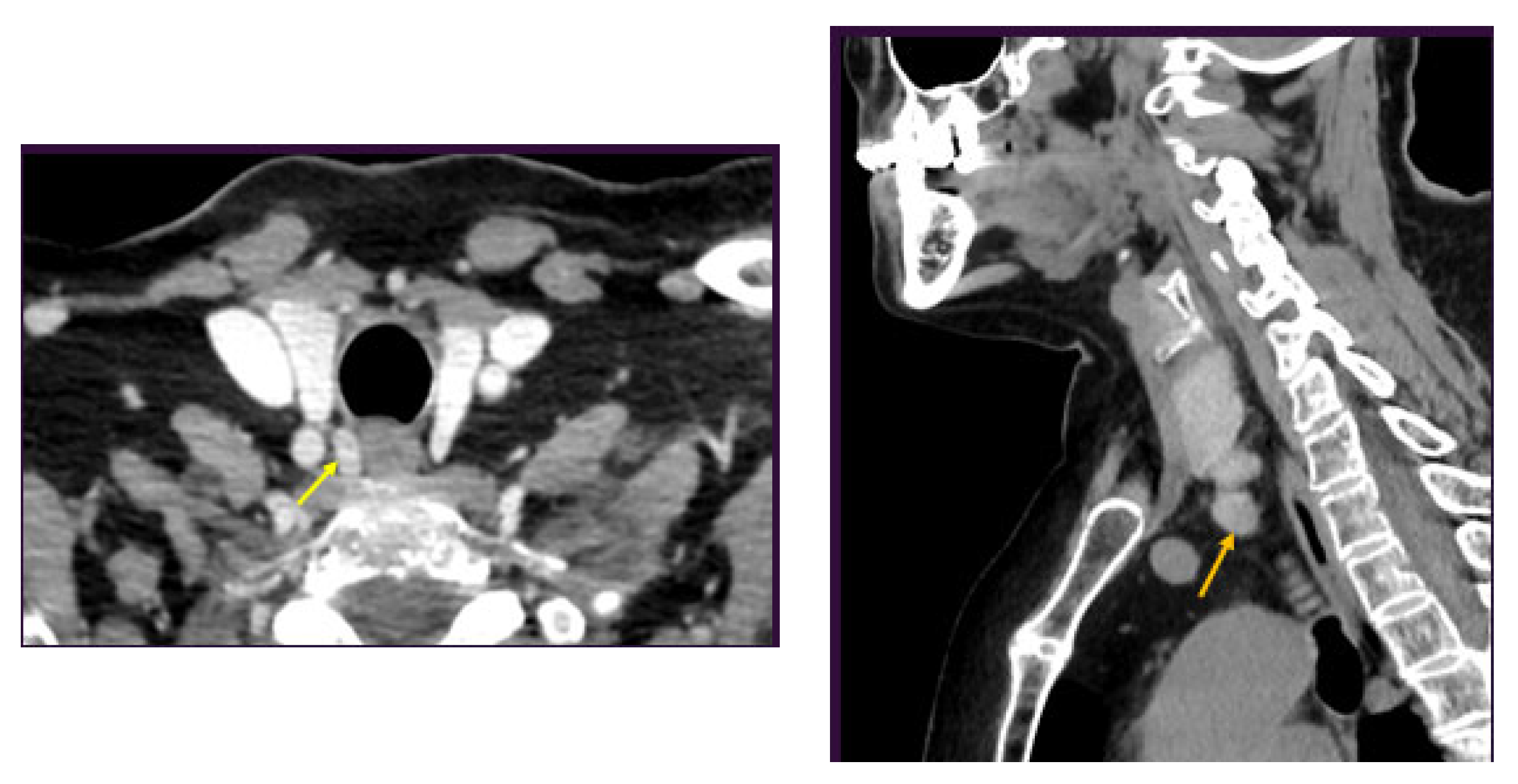 Medicina 60 00015 g003