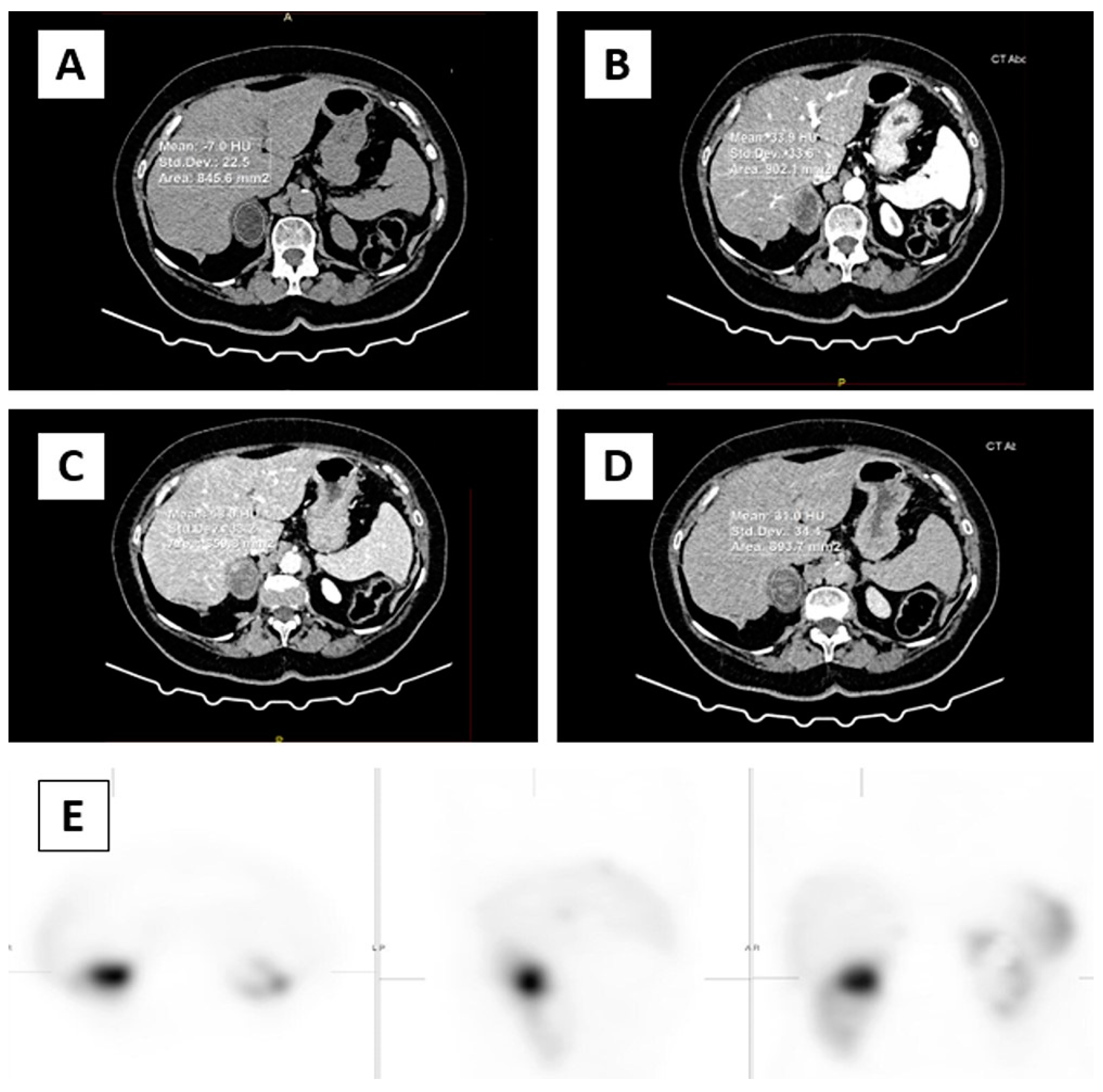 Medicina 60 00072 g001